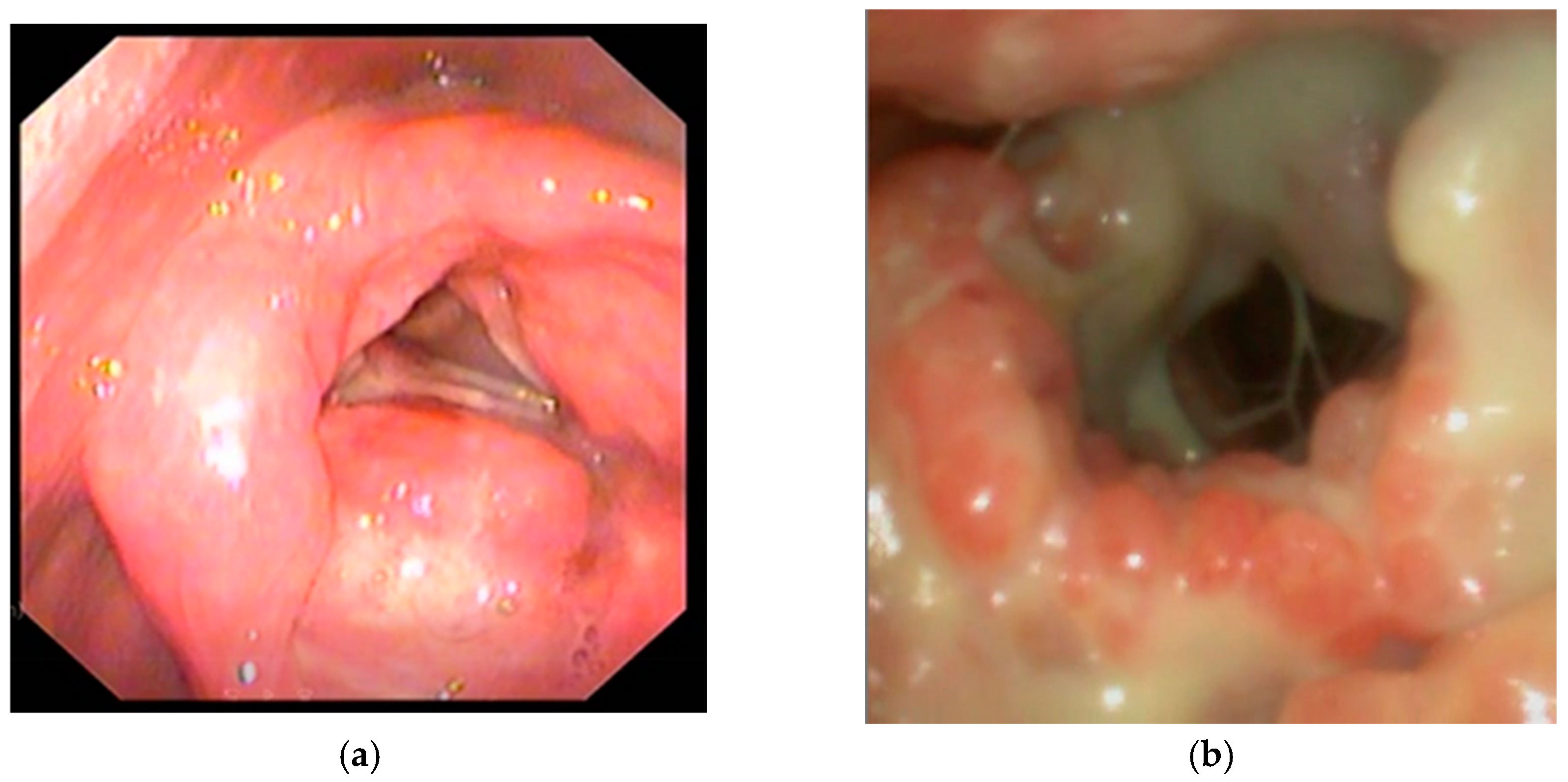 Pathogens 14 00479 g003