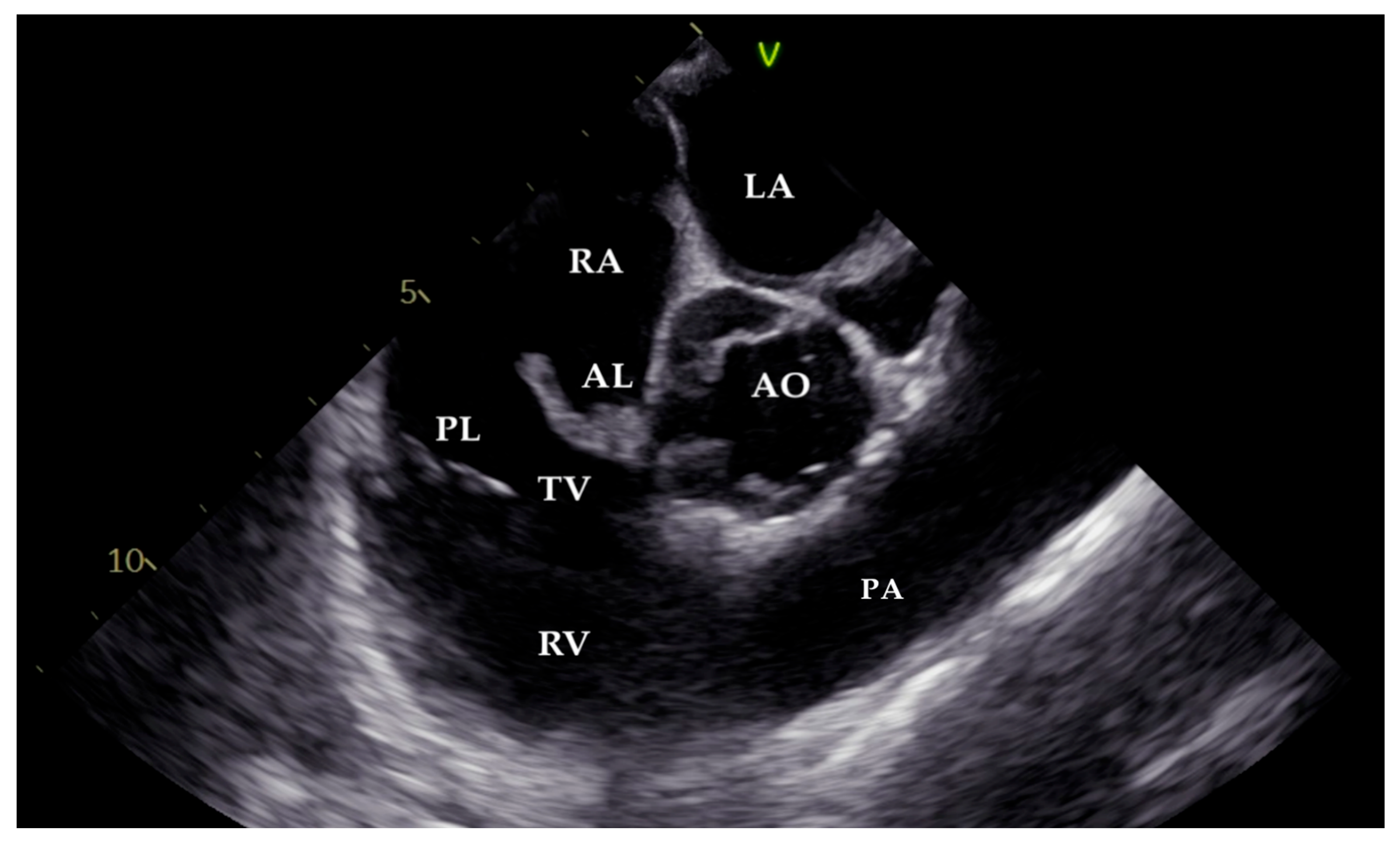 Pathogens 14 00539 g004