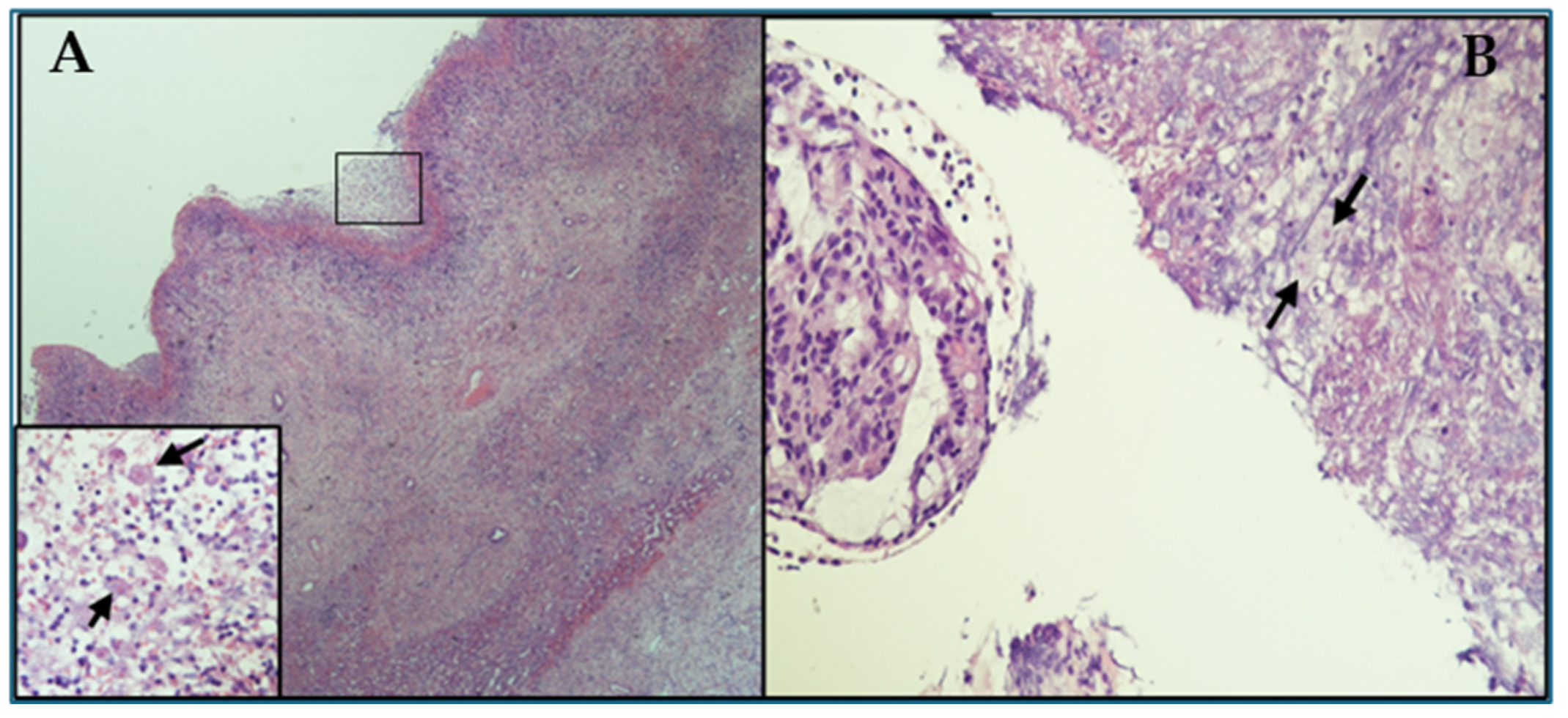 Pathogens 14 00609 g003