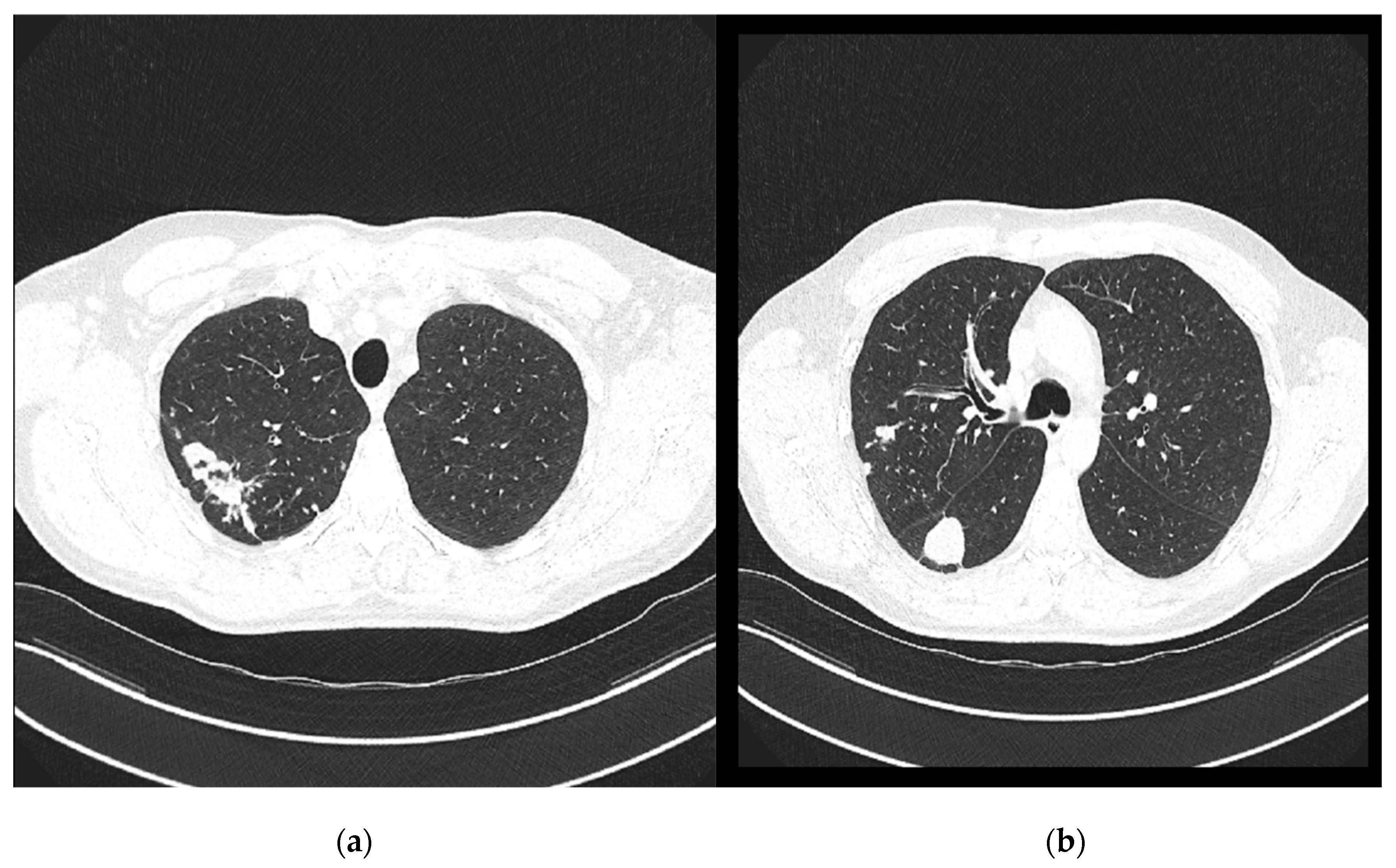 Pathogens 14 00684 g004