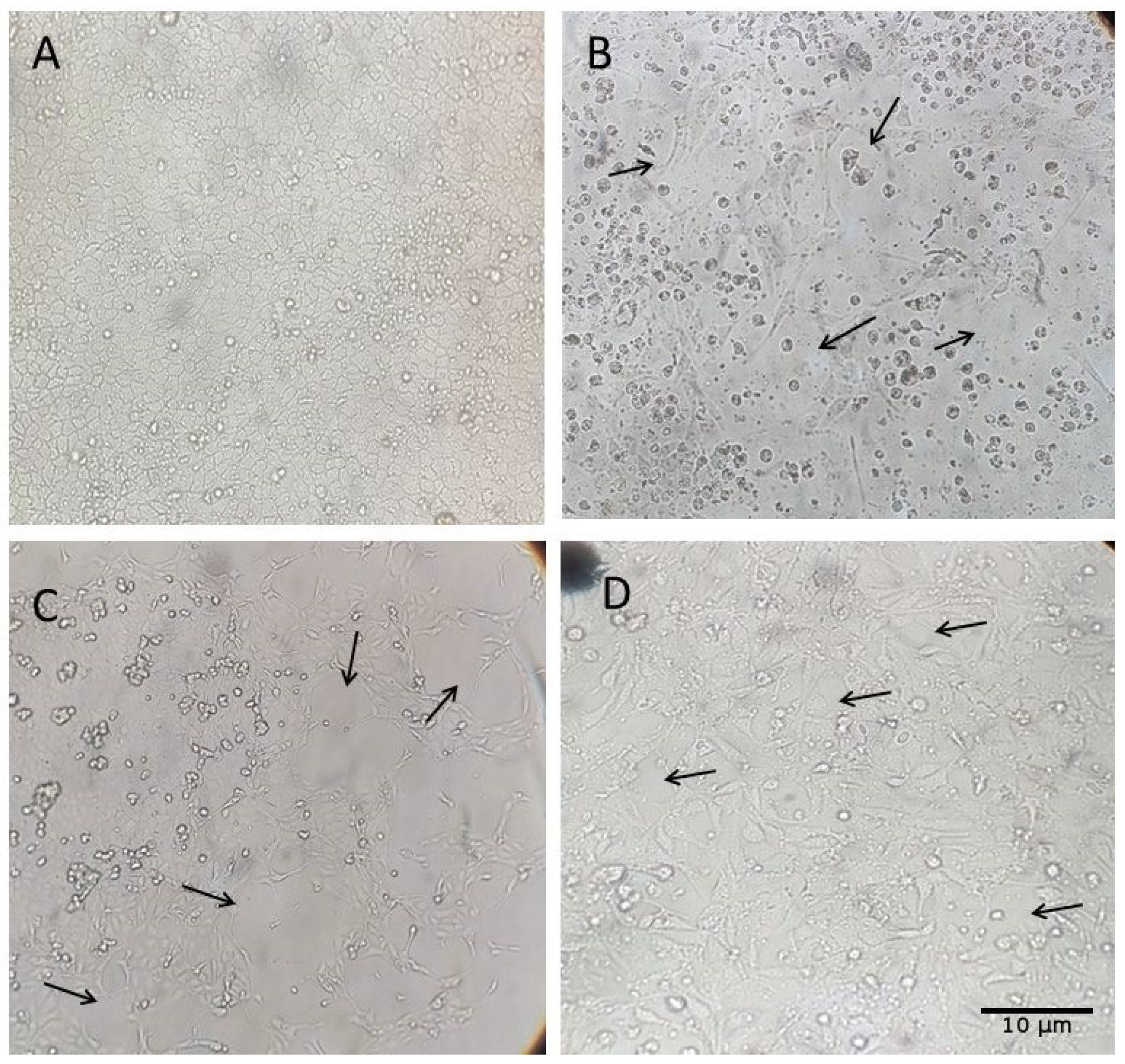 Pathogens 14 00753 g004
