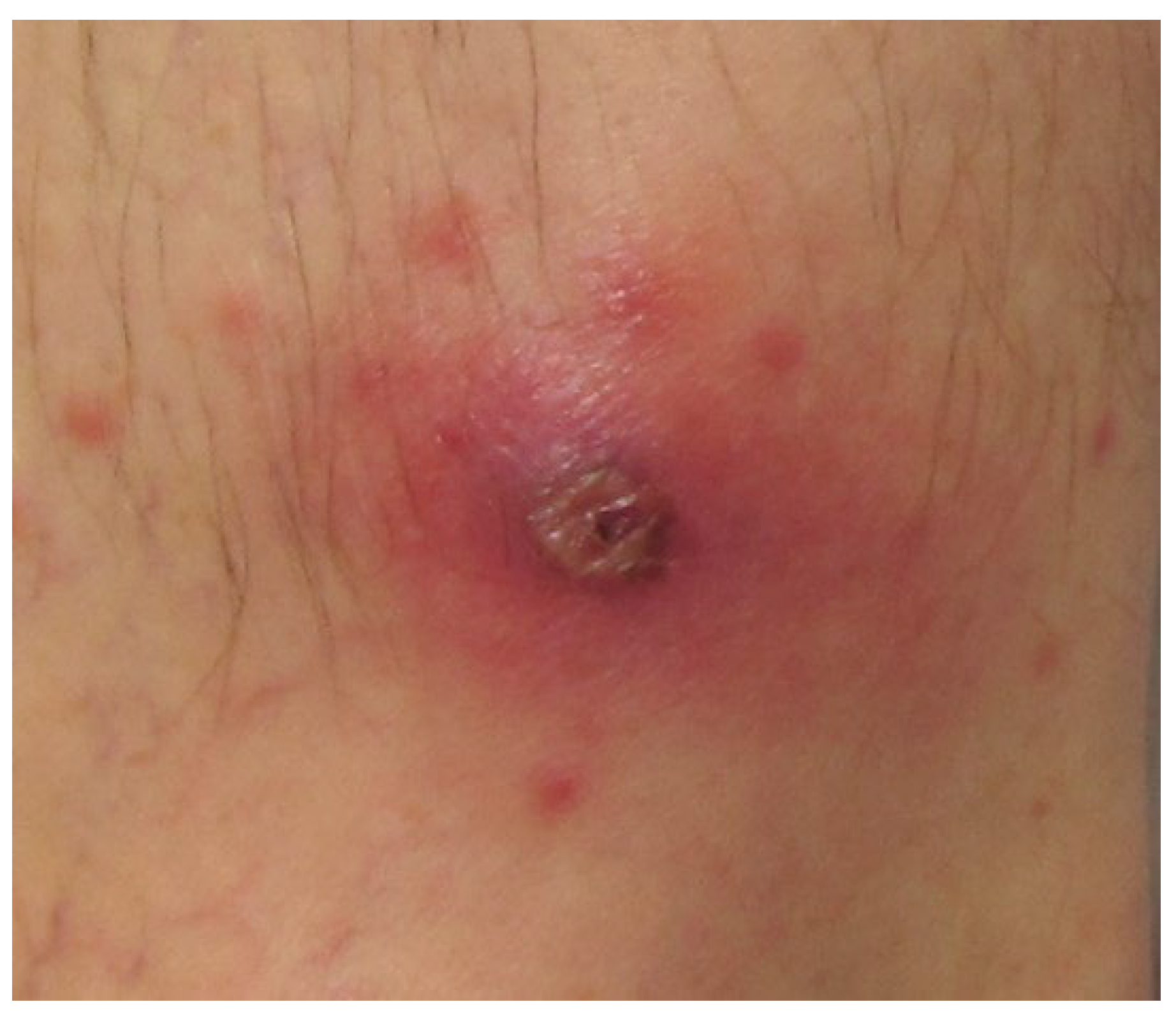 Pathogens 14 00768 g002