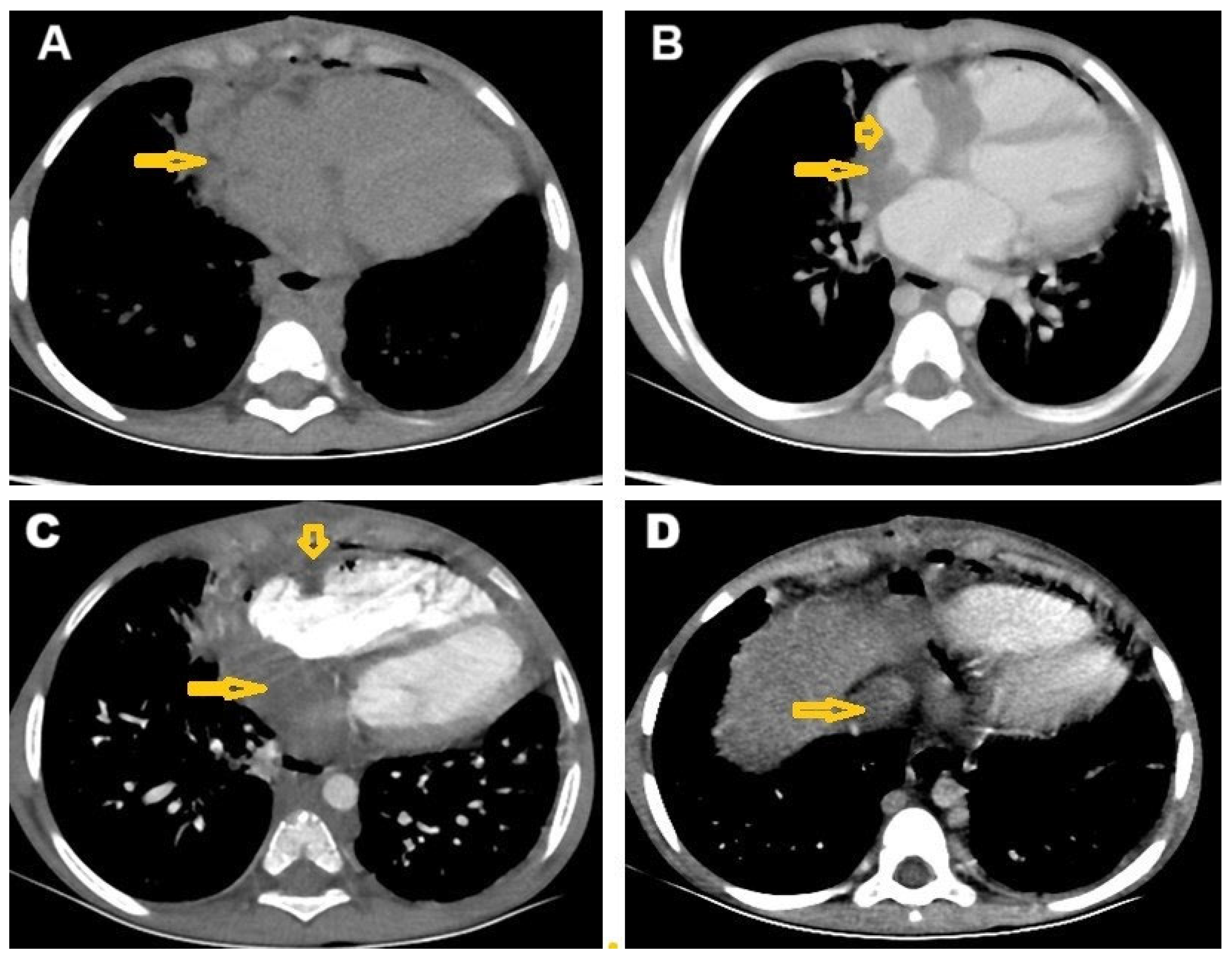 Pathogens 14 00772 g002 Pathogens 14 00772 g002