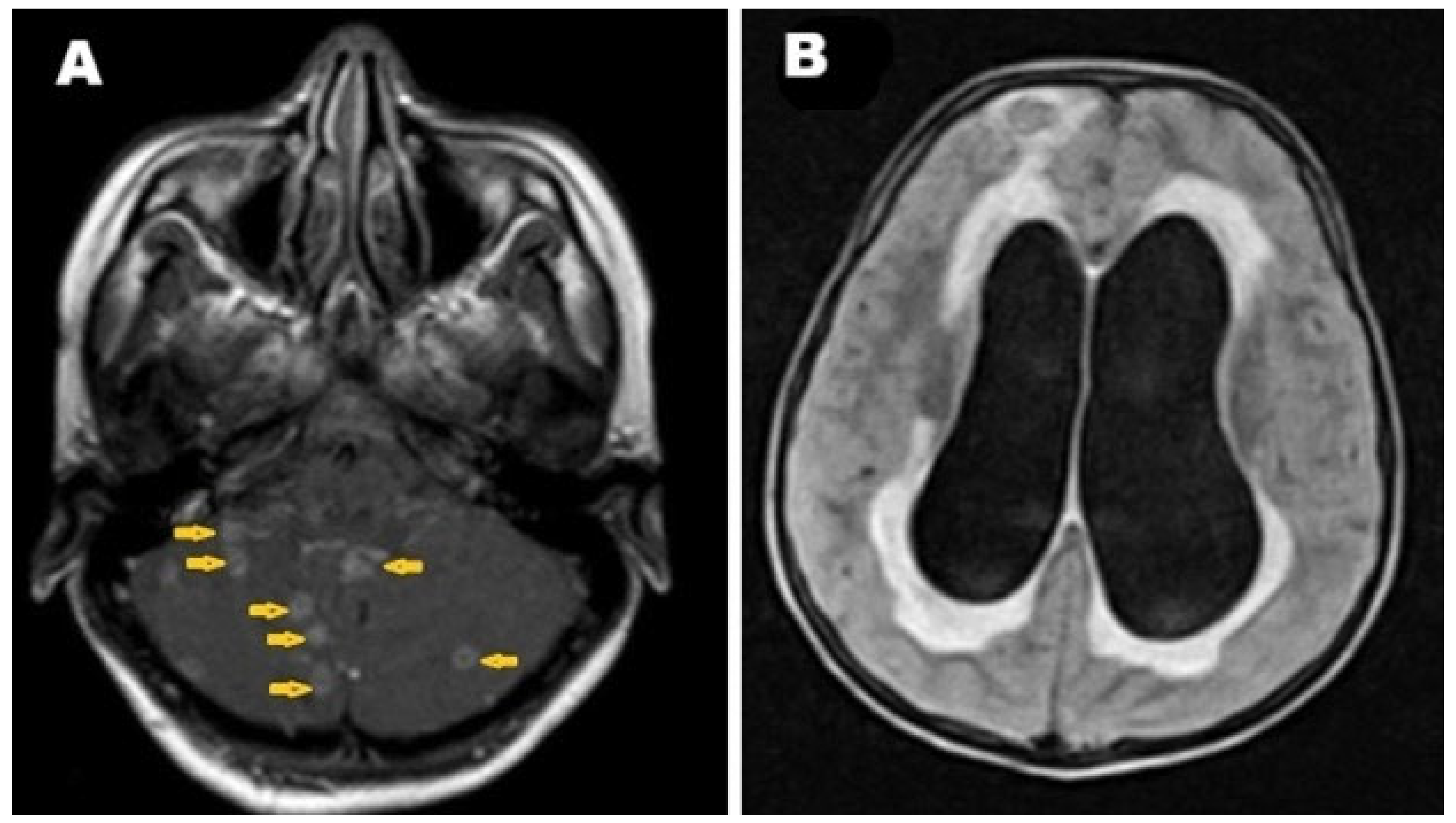 Pathogens 14 00772 g007 Pathogens 14 00772 g007