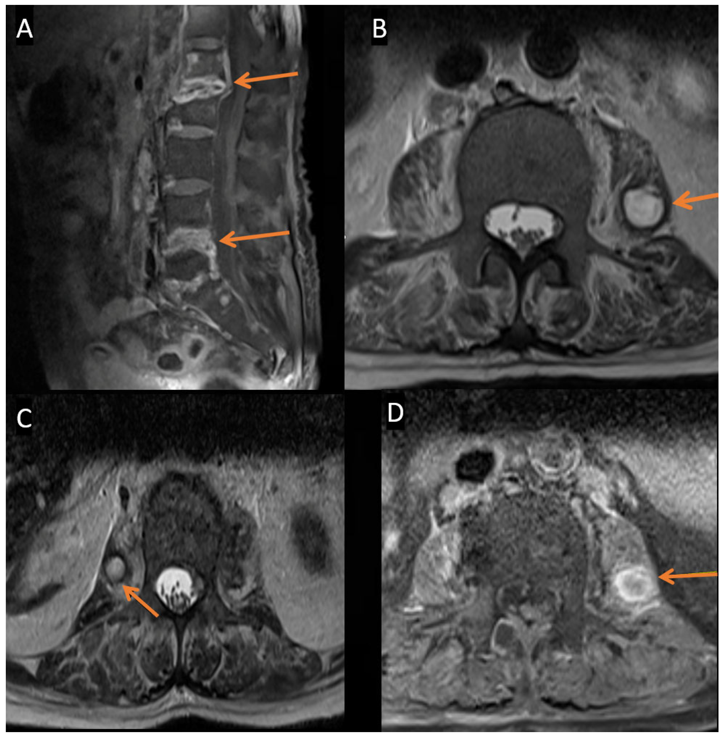 Pathogens 14 00903 g001 Pathogens 14 00903 g001