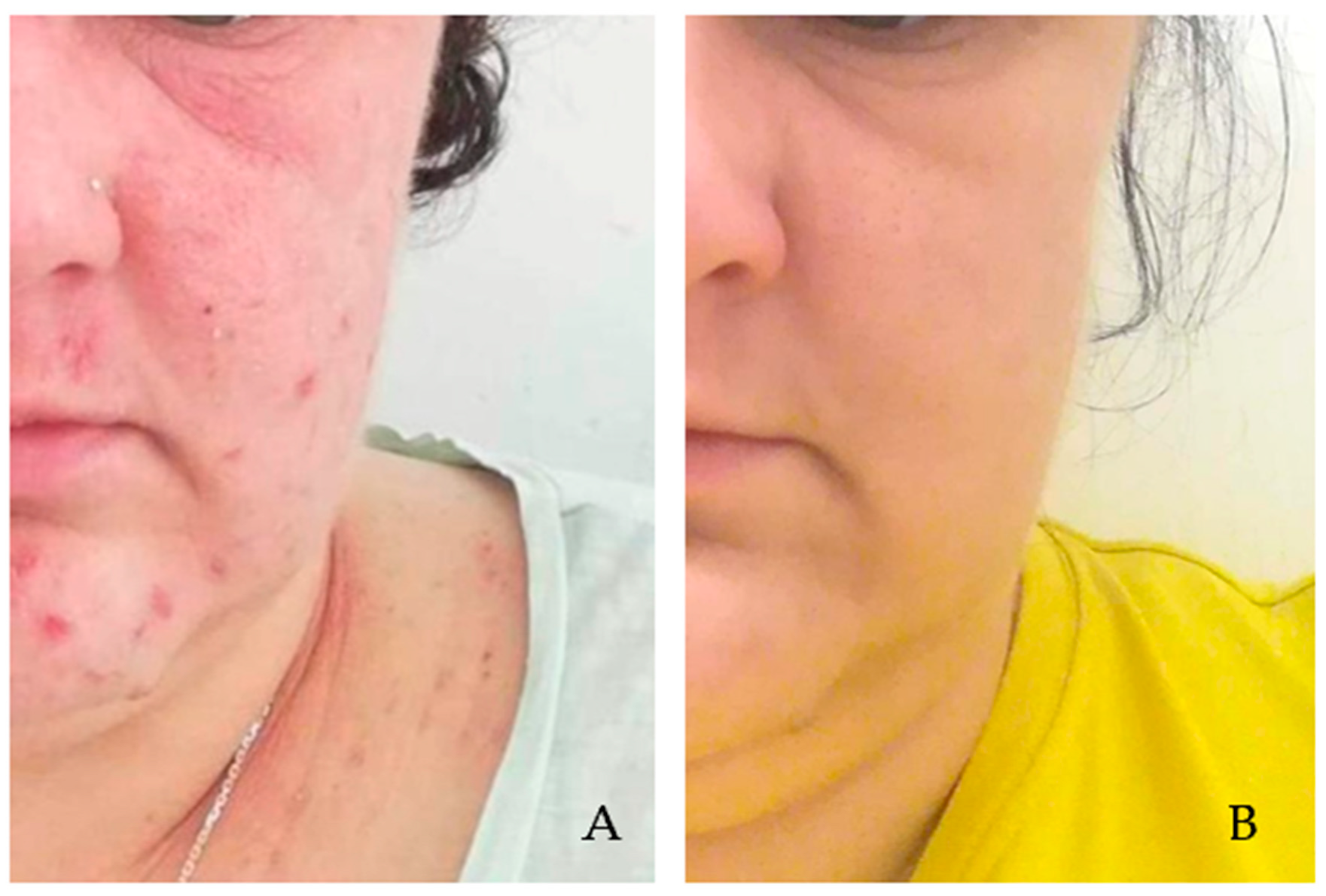 Pathogens 14 00956 g002 Pathogens 14 00956 g002