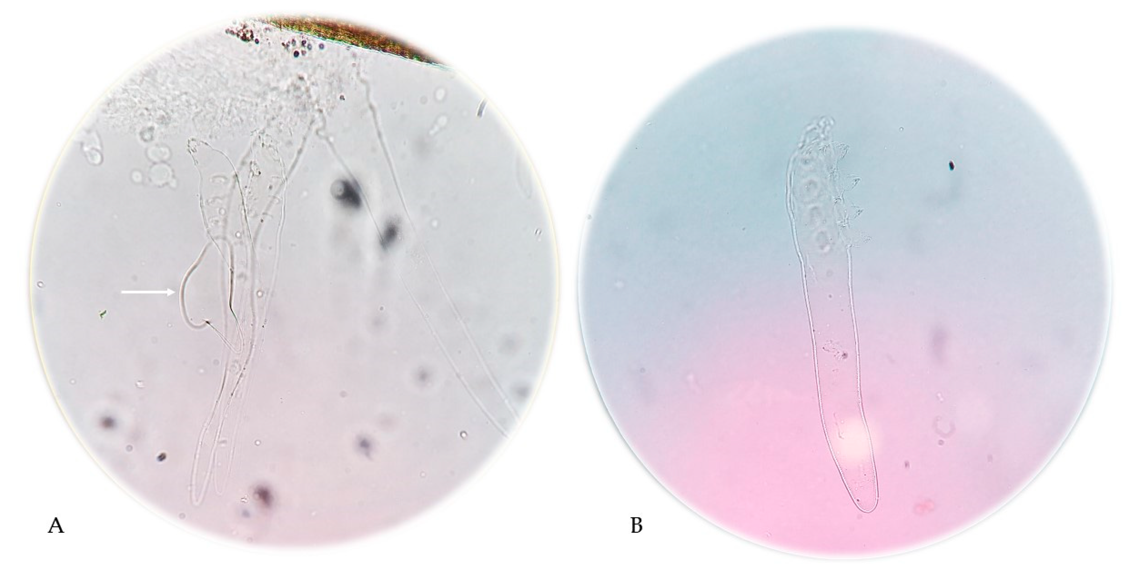 Pathogens 14 00956 g003 Pathogens 14 00956 g003