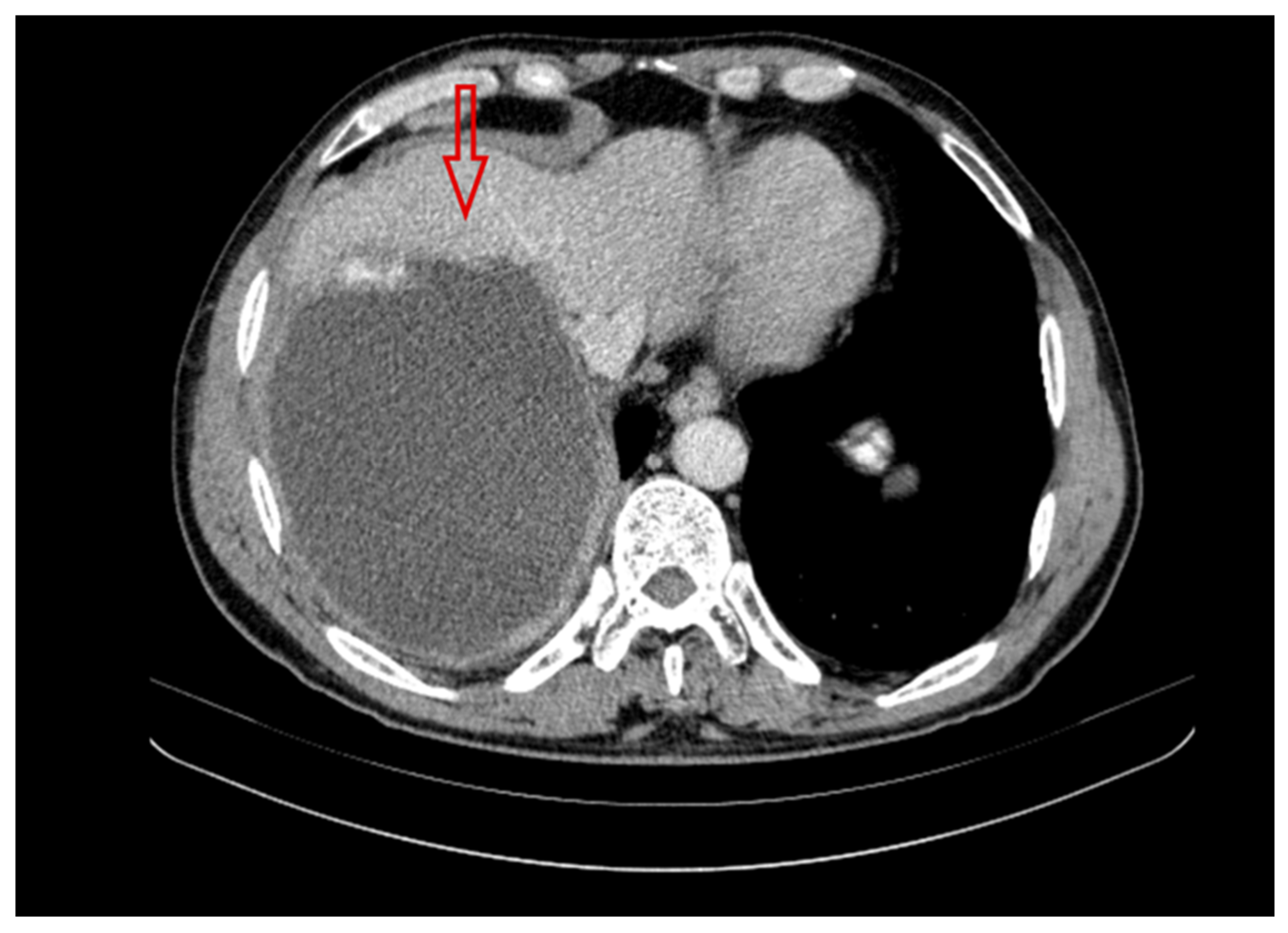 Pathogens 14 00957 g003 Pathogens 14 00957 g003