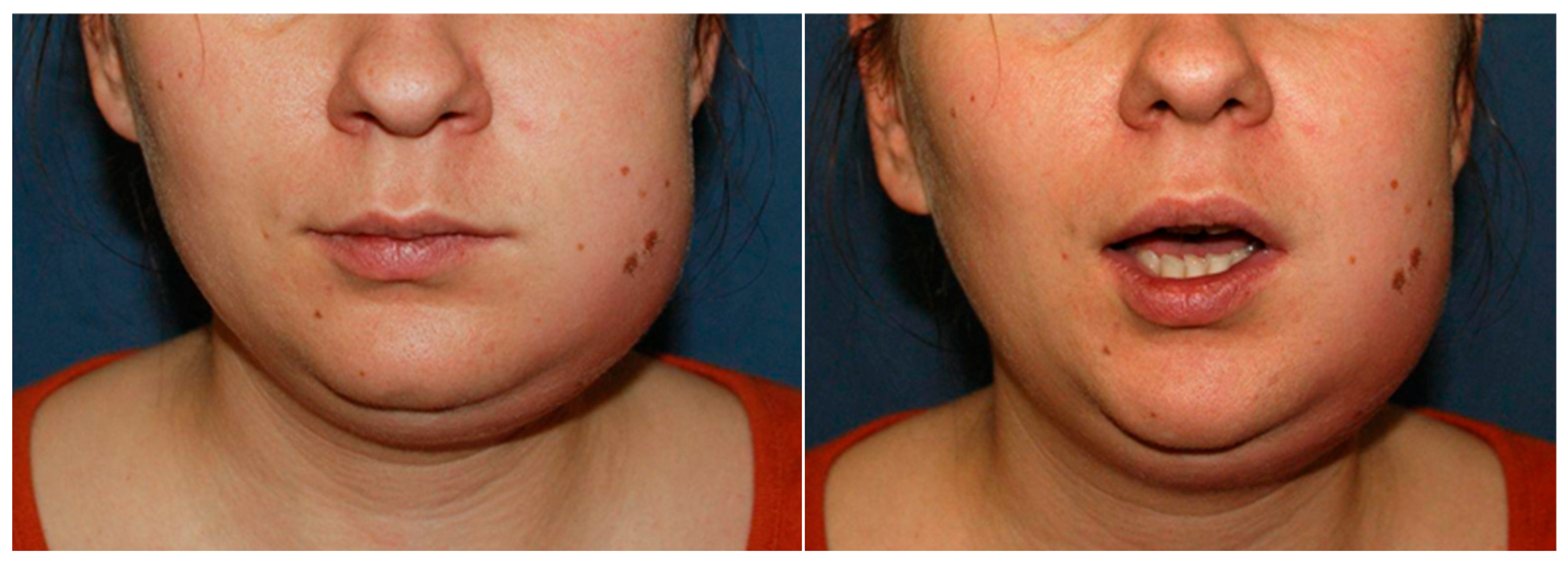 Pathogens 14 01024 g003 Pathogens 14 01024 g003