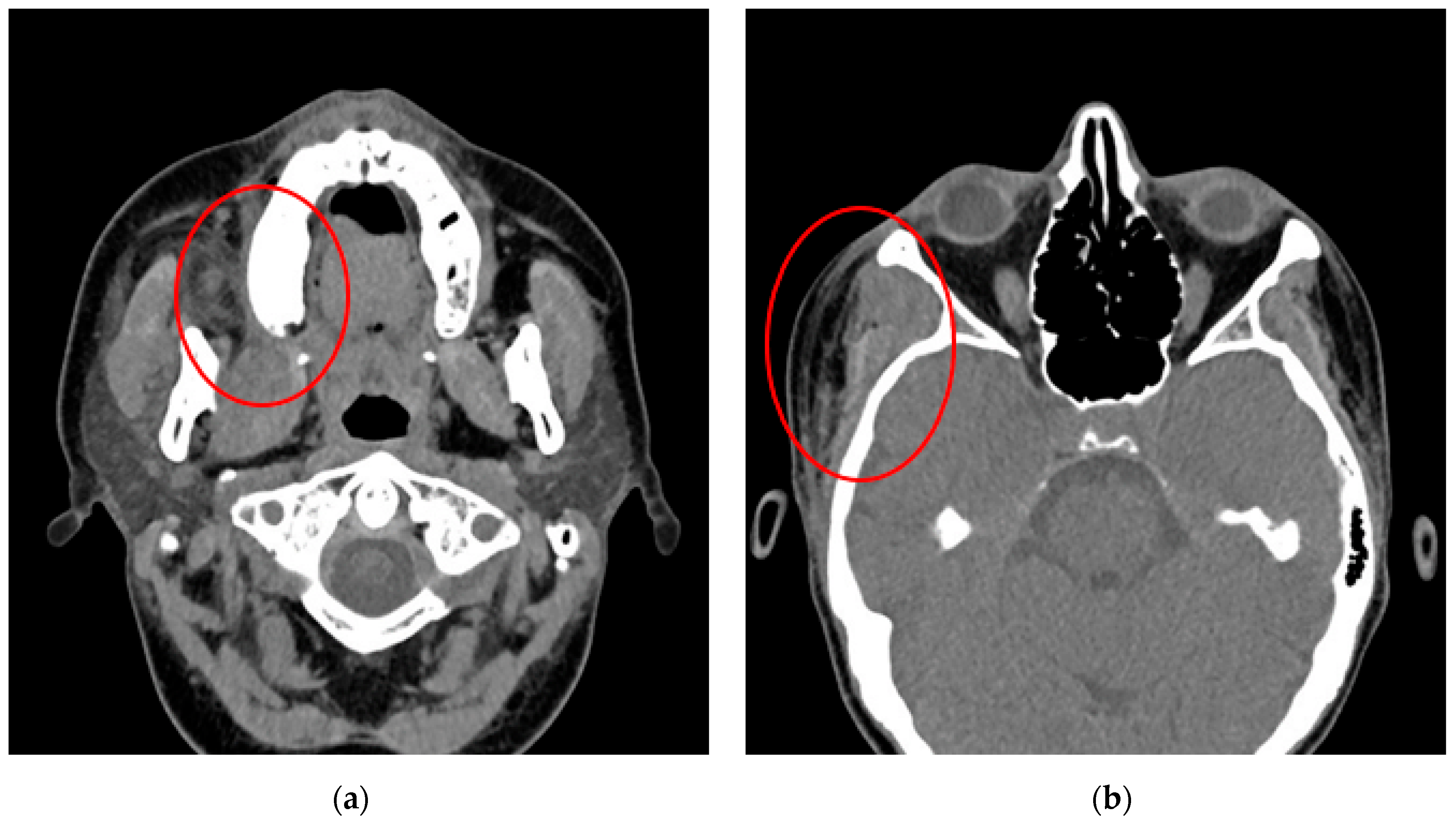 Pathogens 14 01024 g004 Pathogens 14 01024 g004