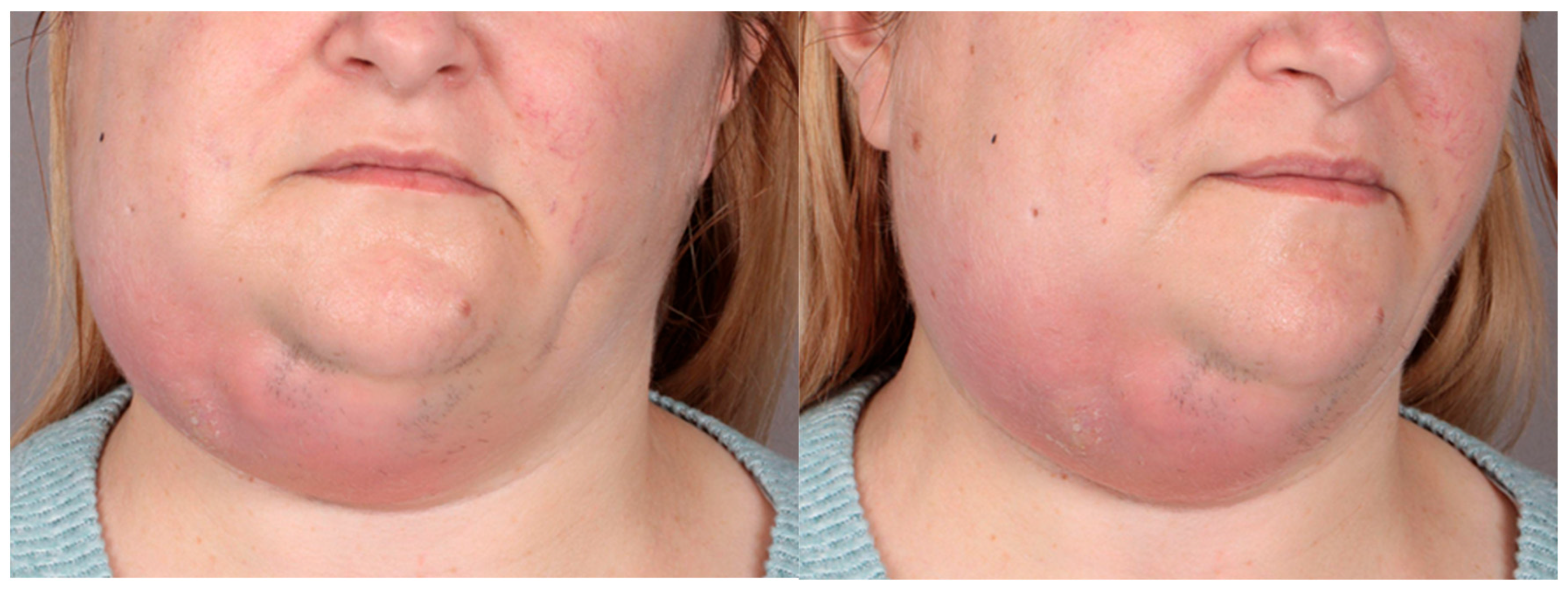 Pathogens 14 01024 g005 Pathogens 14 01024 g005