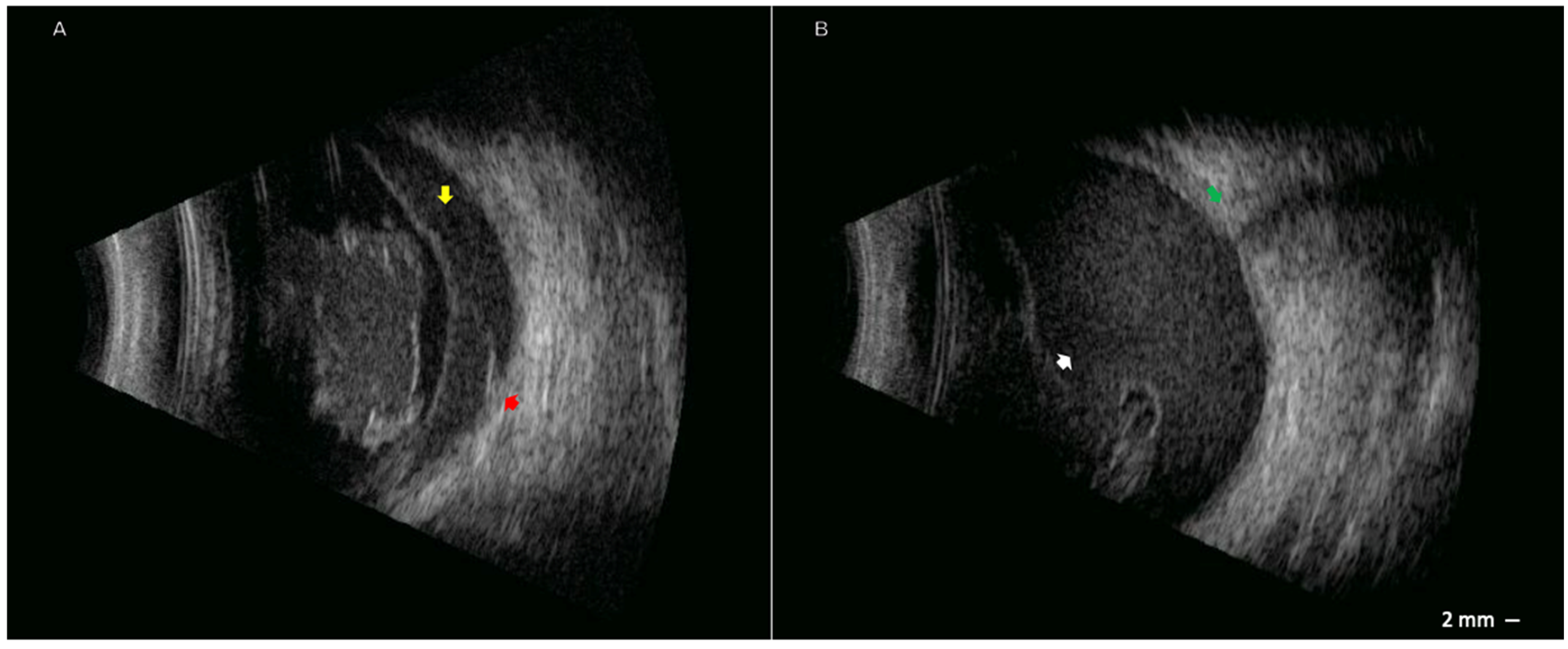 Pathogens 14 01222 g001