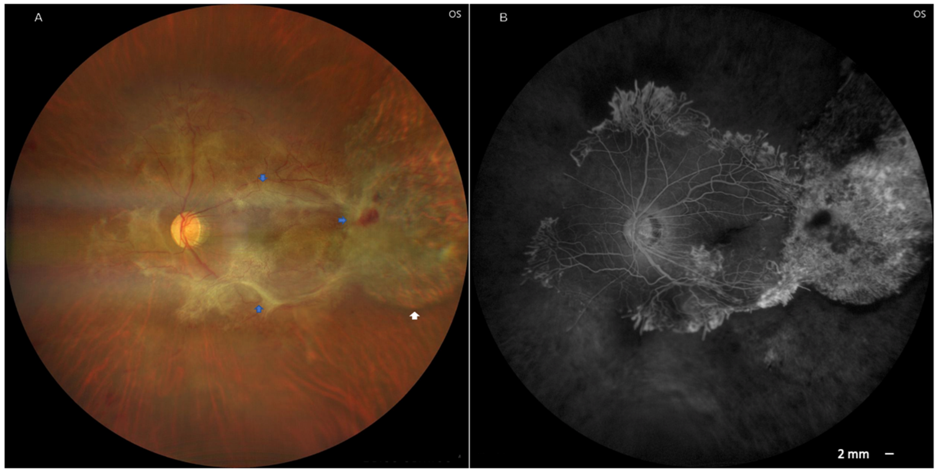 Pathogens 14 01222 g003