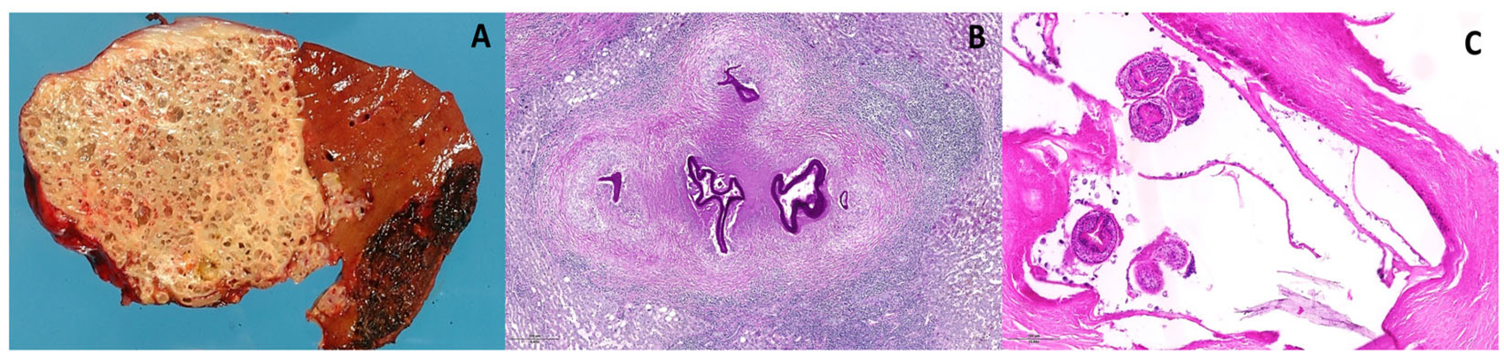 Pathogens 15 00495 g002