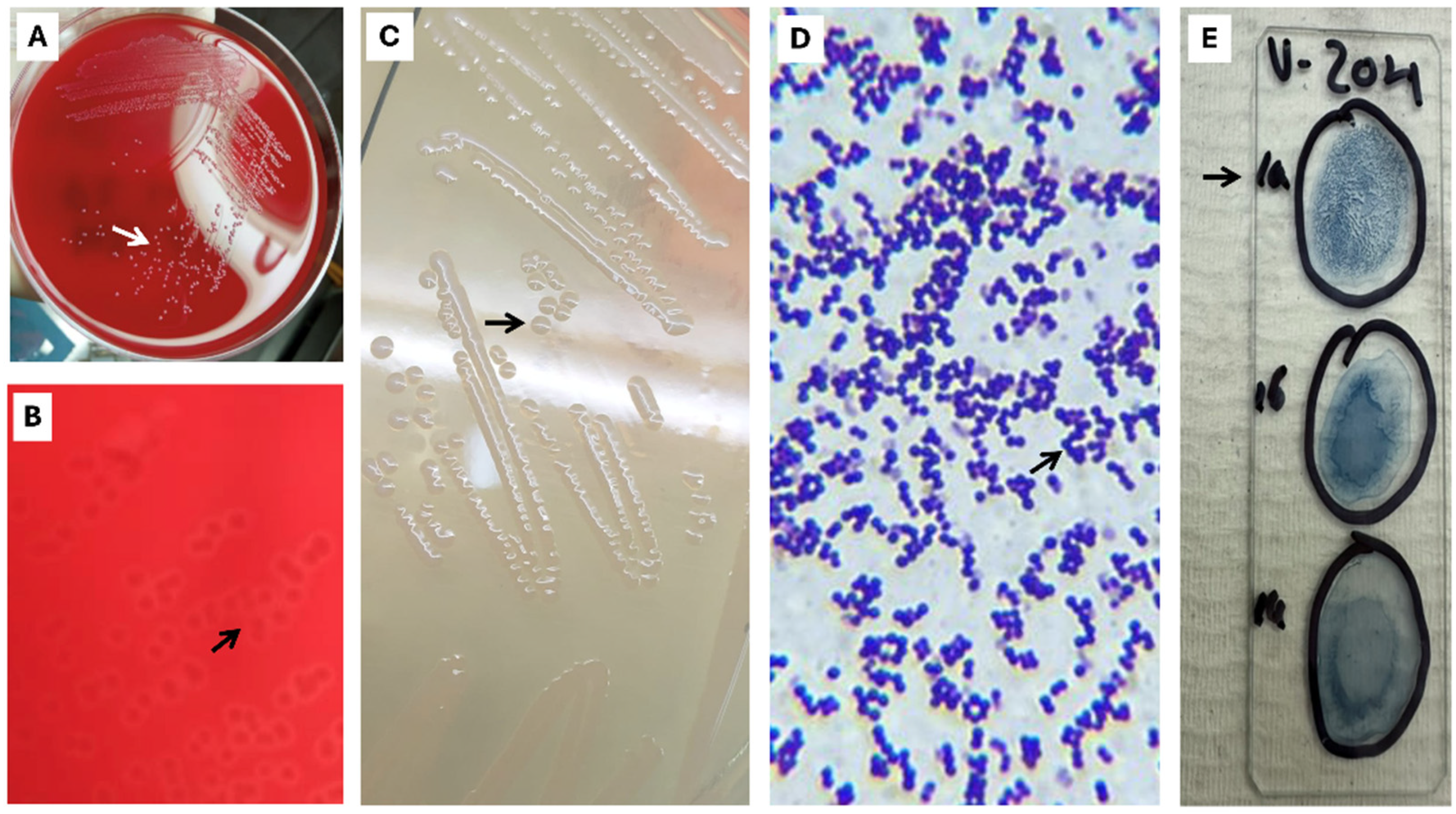 Pathogens 15 00545 g001