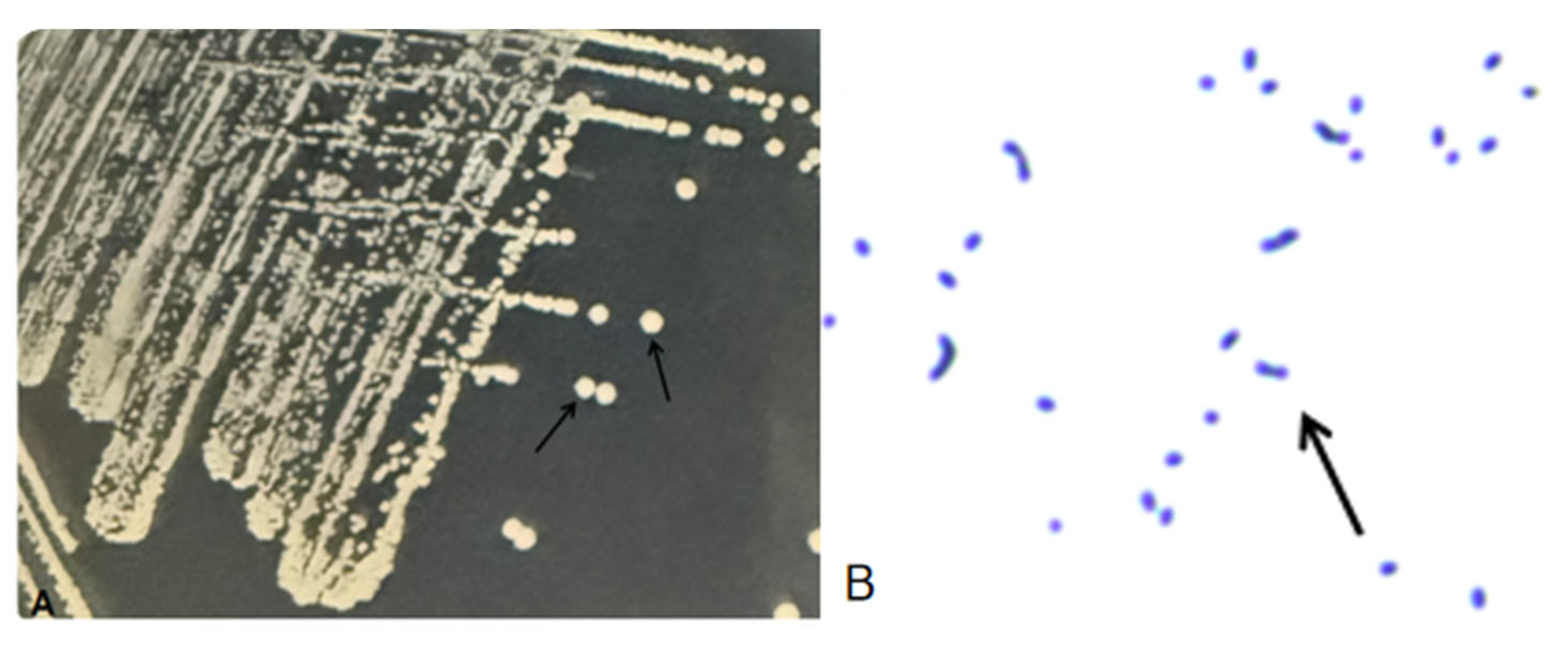 Pathogens 15 00578 g002 Pathogens 15 00578 g002