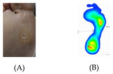 Pathophysiology 27 00003 i005 Pathophysiology 27 00003 i005