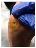 Pathophysiology 27 00003 i007 Pathophysiology 27 00003 i007