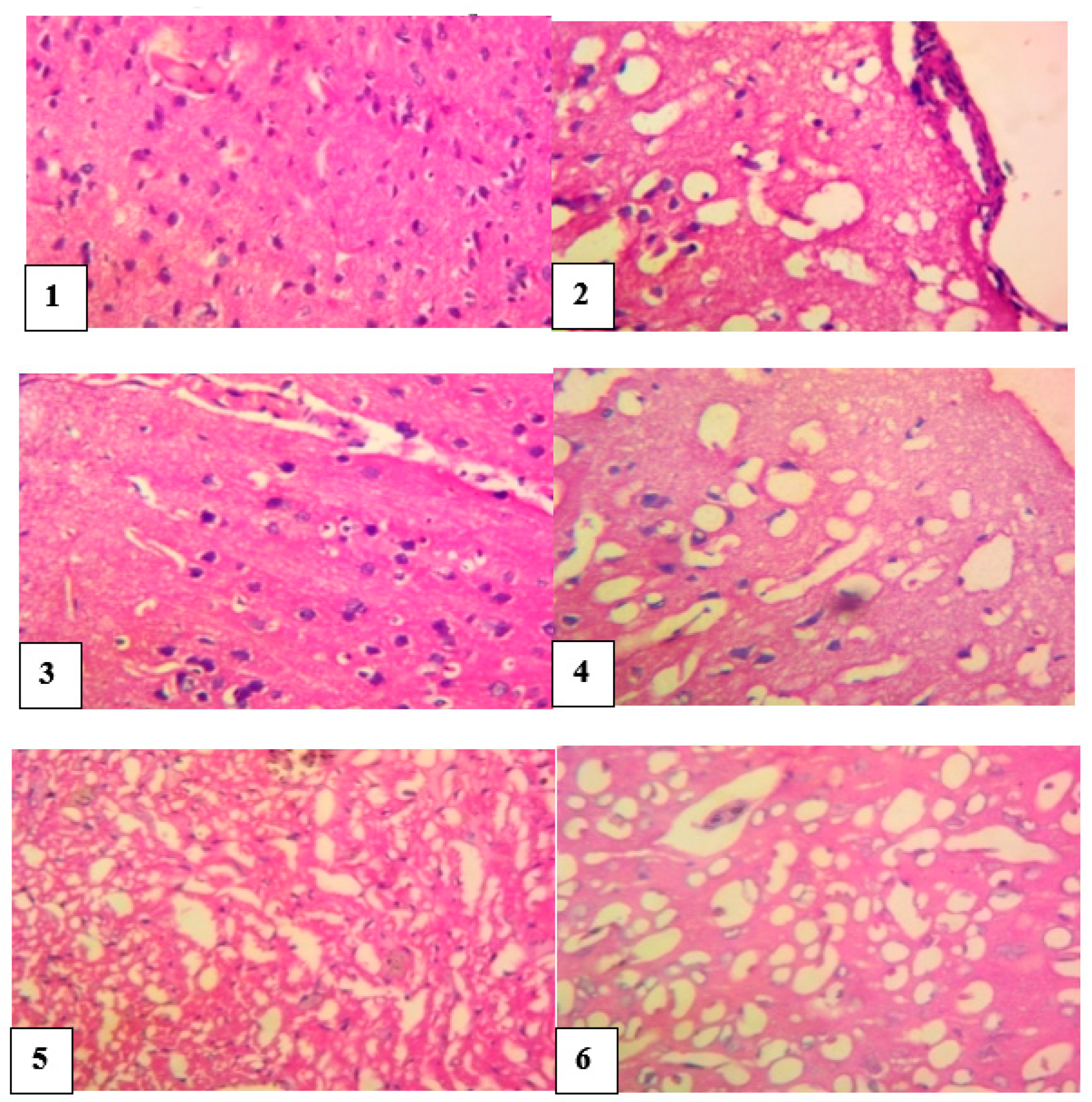 Pathophysiology 28 00009 g006