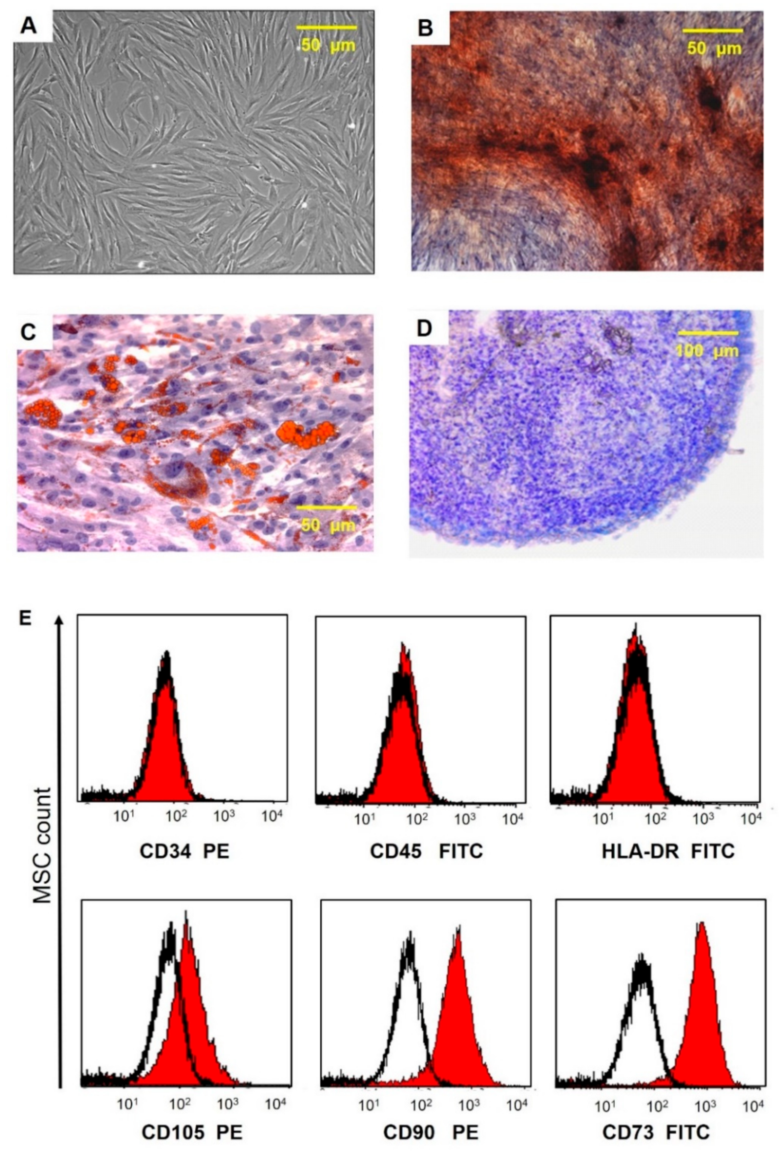 Local and Remote Effects of Mesenchymal Stem Cell