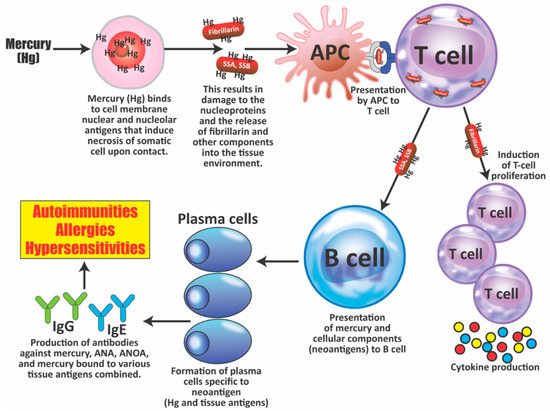 The Role of Exposomes in the Pathophysiology of Autoimmune