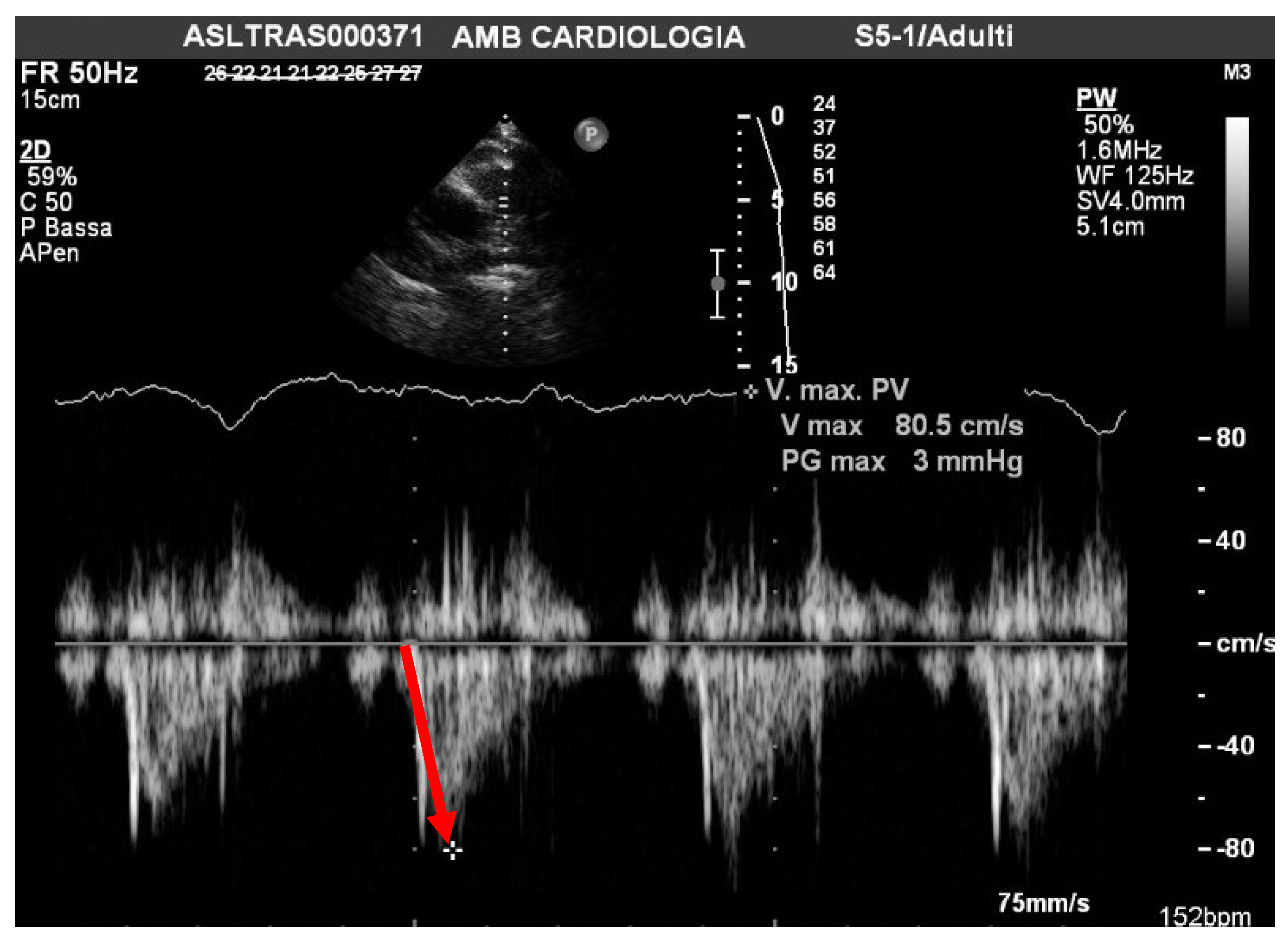 Pathophysiology 29 00012 g001 Pathophysiology 29 00012 g001