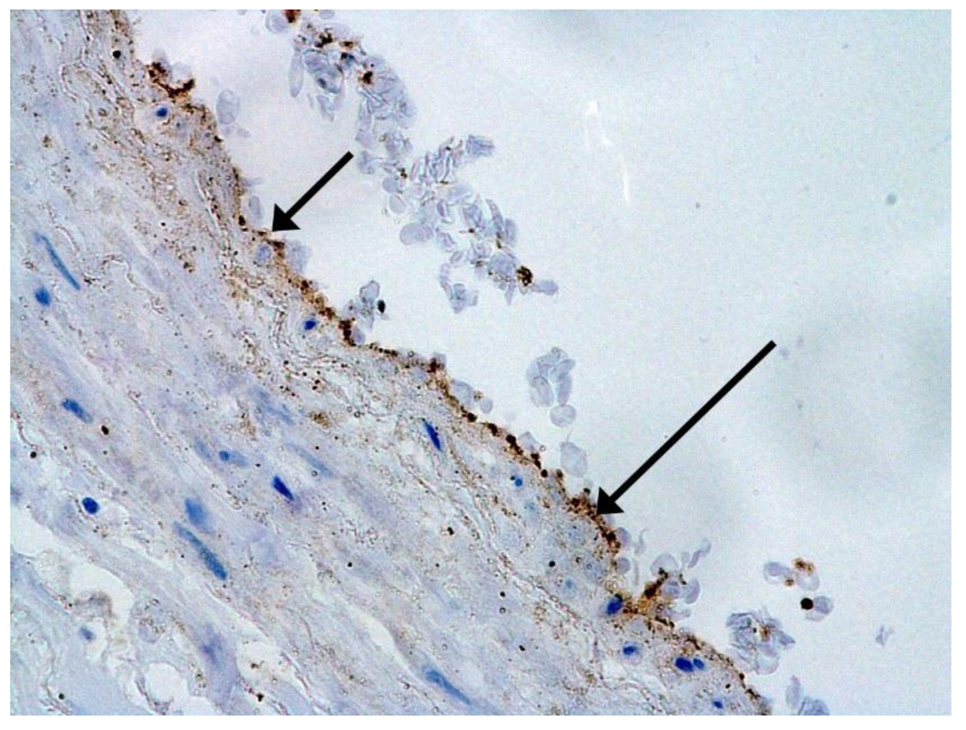 Pathophysiology 29 00021 g001 550