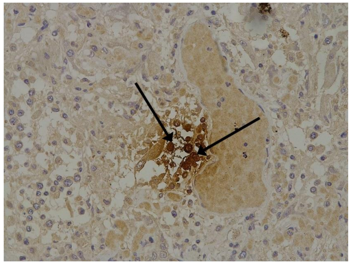 Pathophysiology 29 00021 g002 550