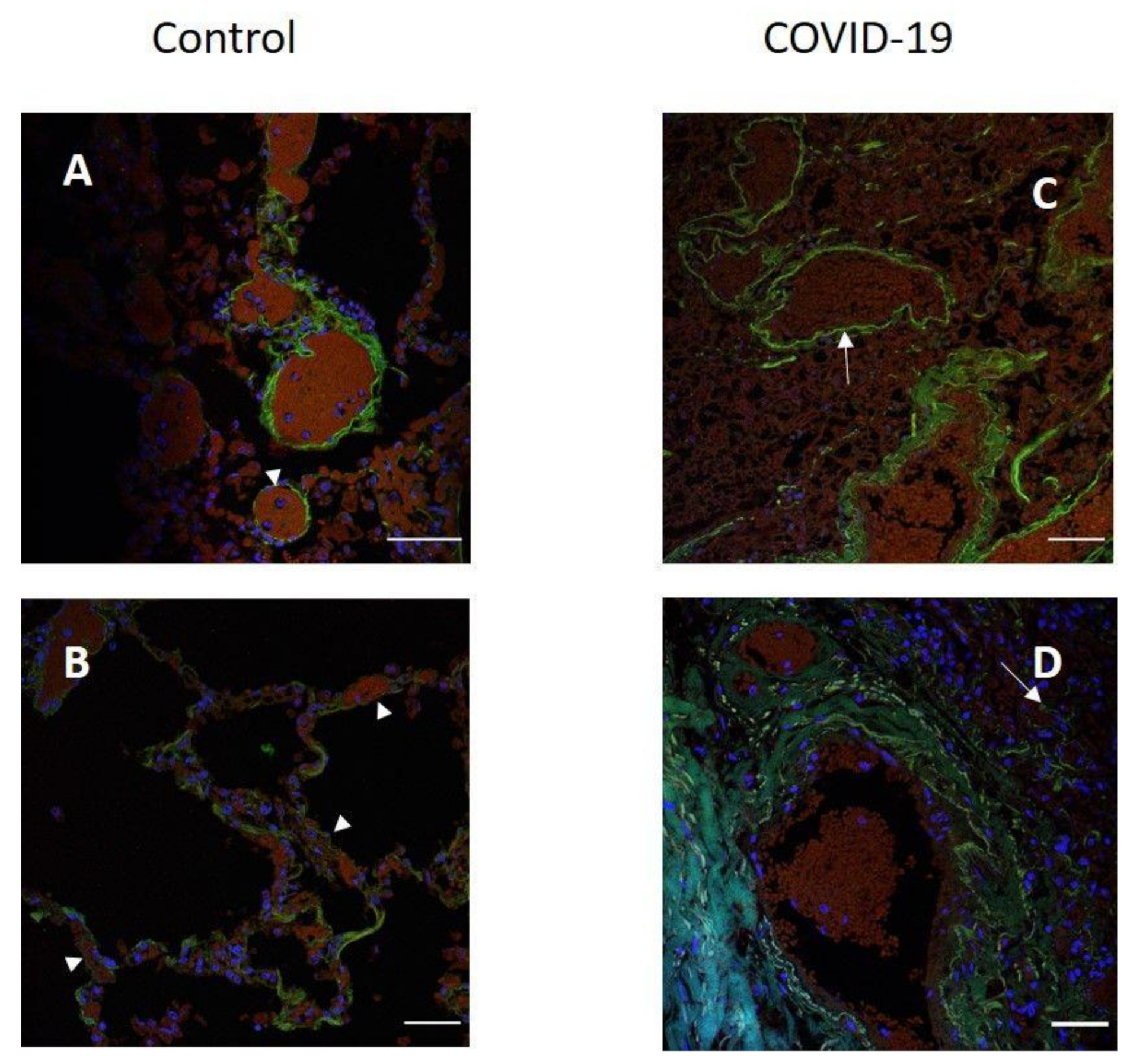 Pathophysiology 29 00021 g003 550