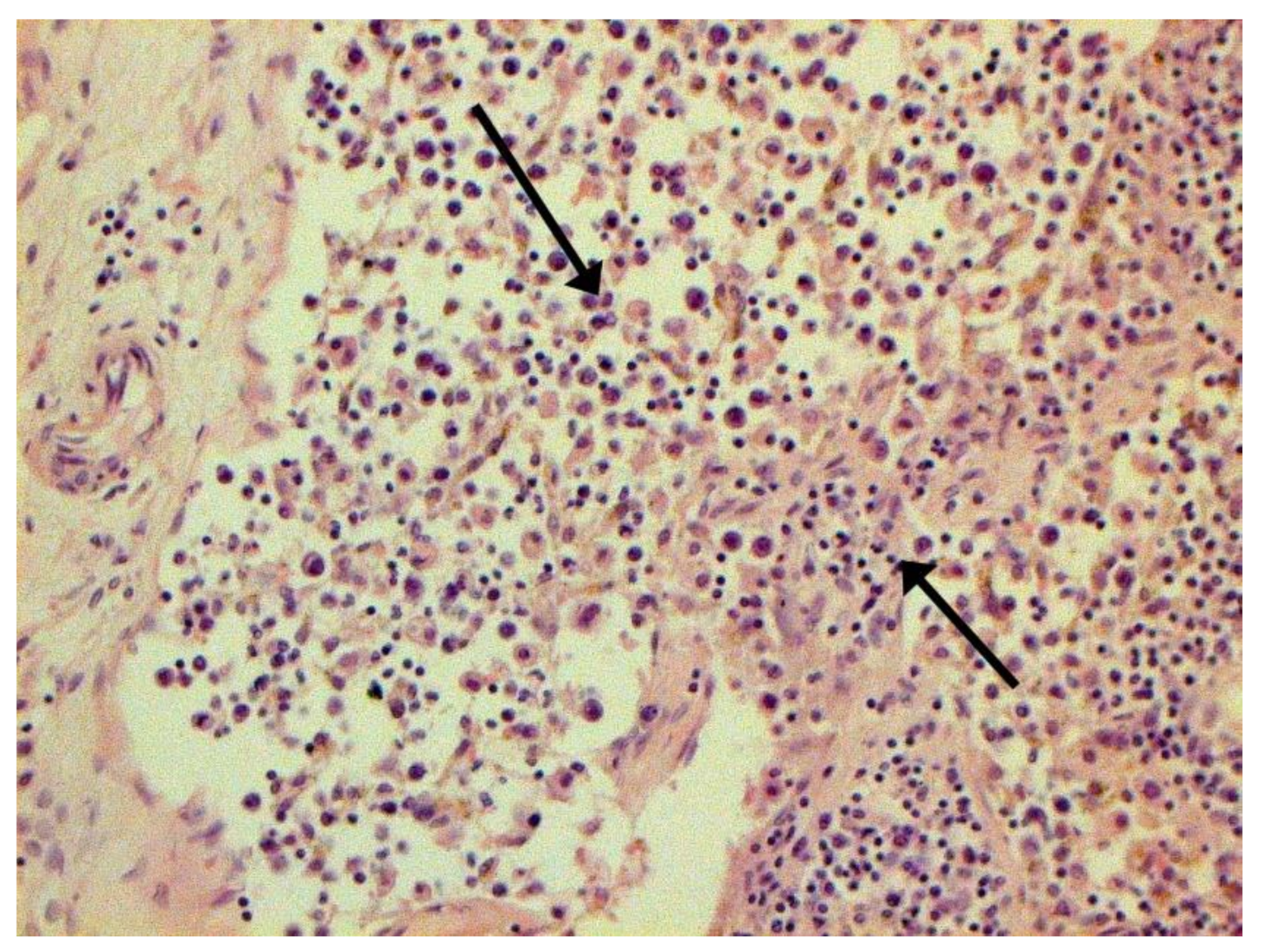 Pathophysiology 29 00021 g005 550