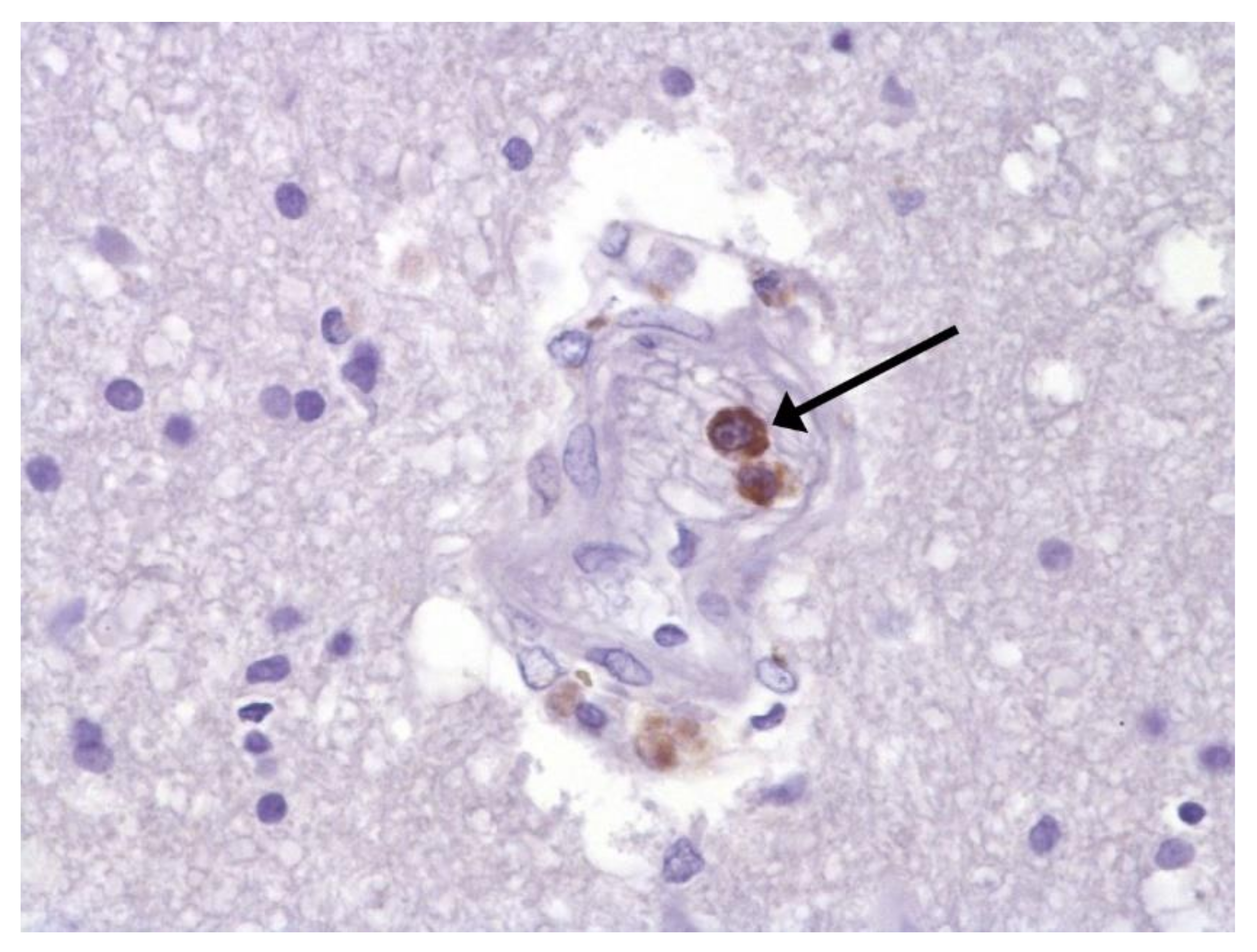 Pathophysiology 29 00021 g007 550