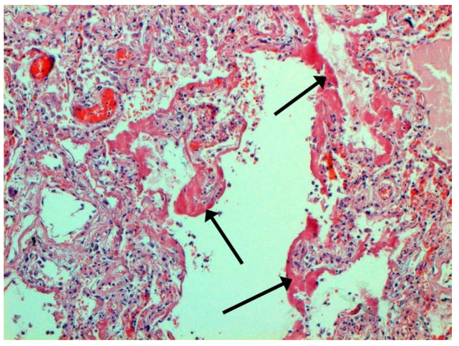 Pathophysiology 29 00021 g009 550