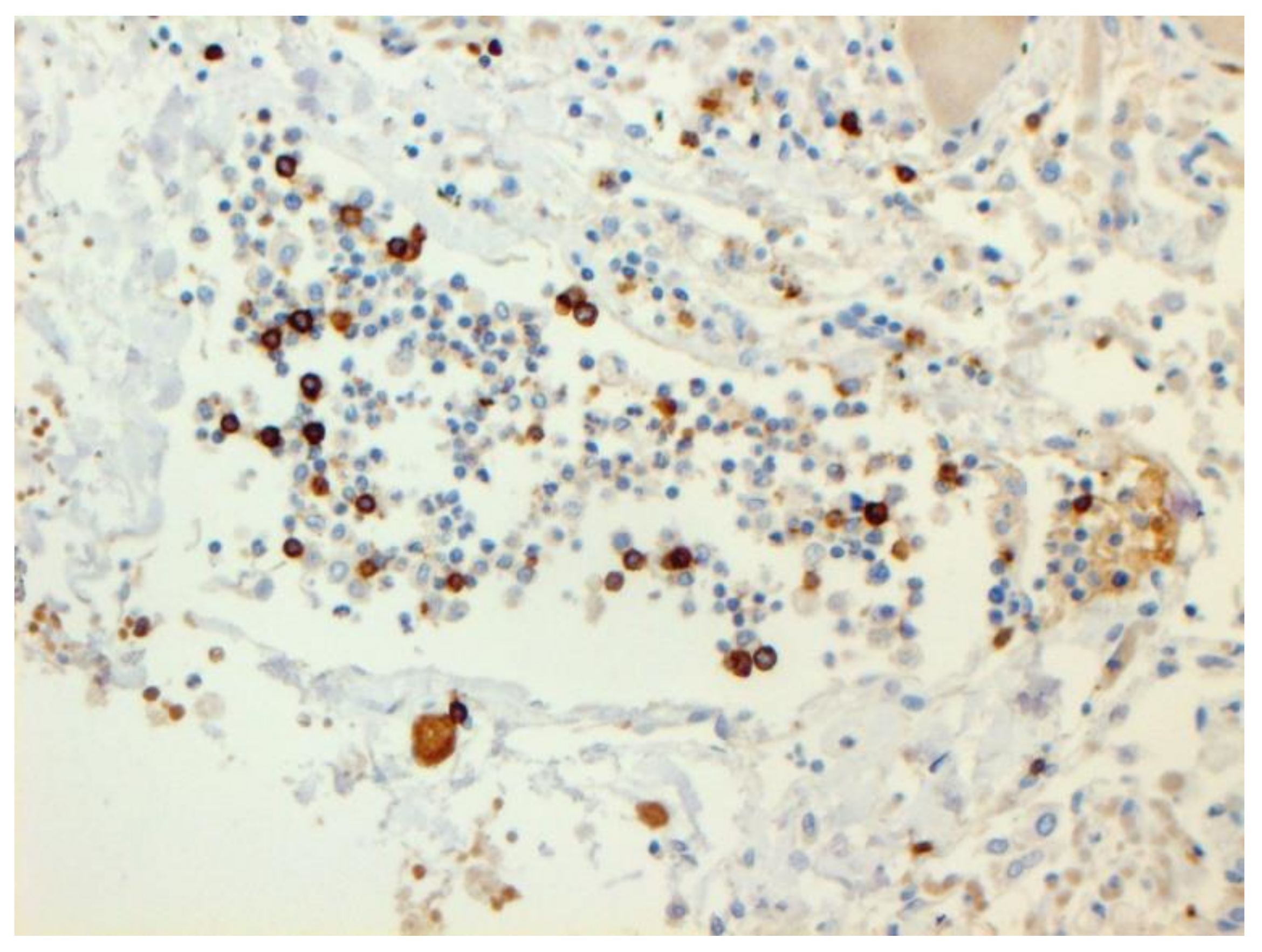 Pathophysiology 29 00021 g011 550