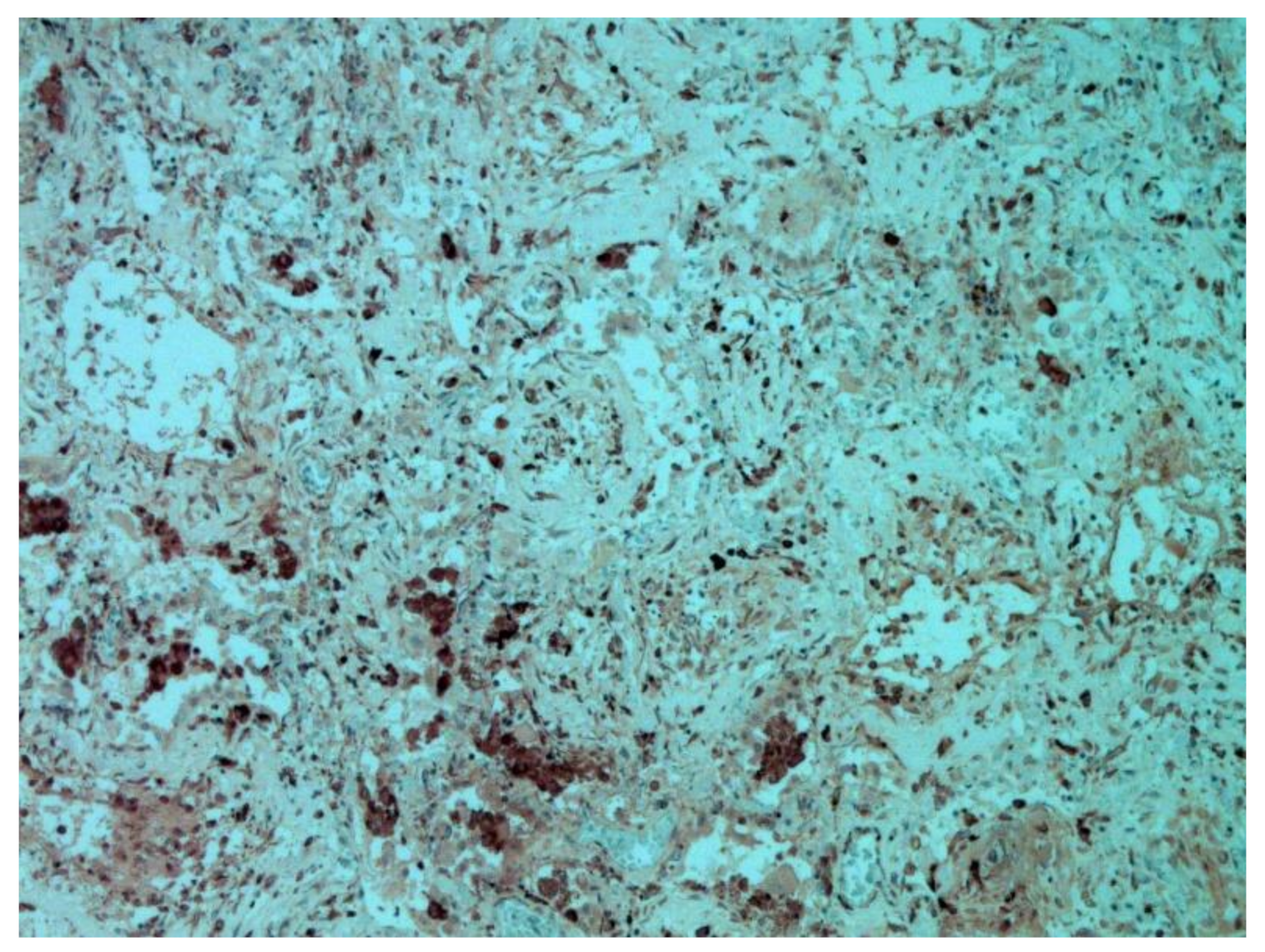 Pathophysiology 29 00021 g012 550