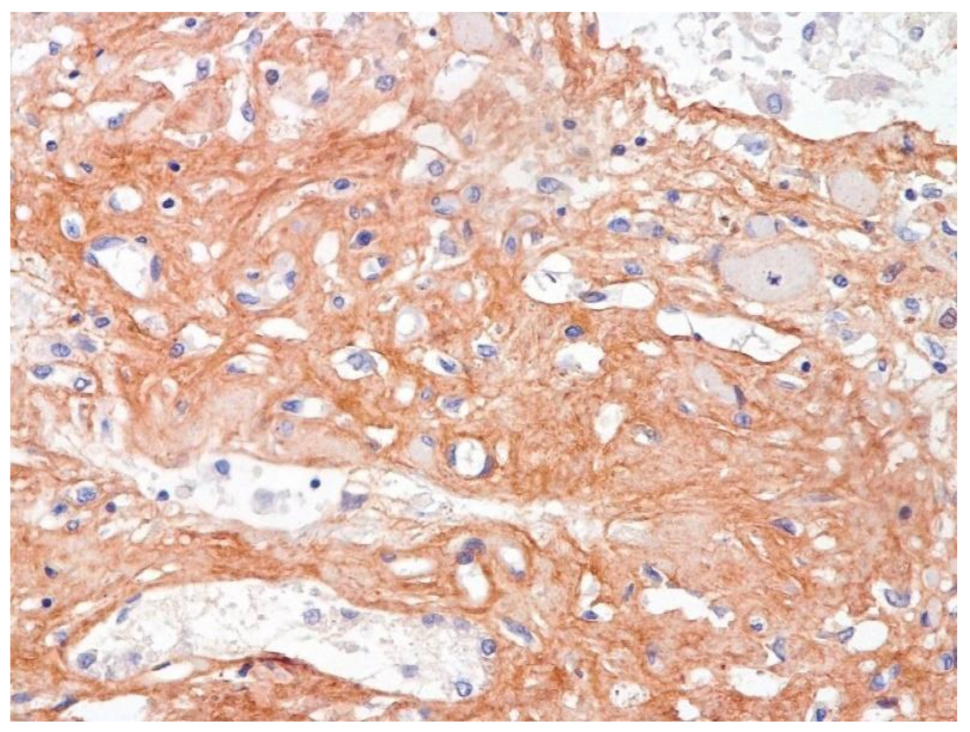 Pathophysiology 29 00021 g013 550