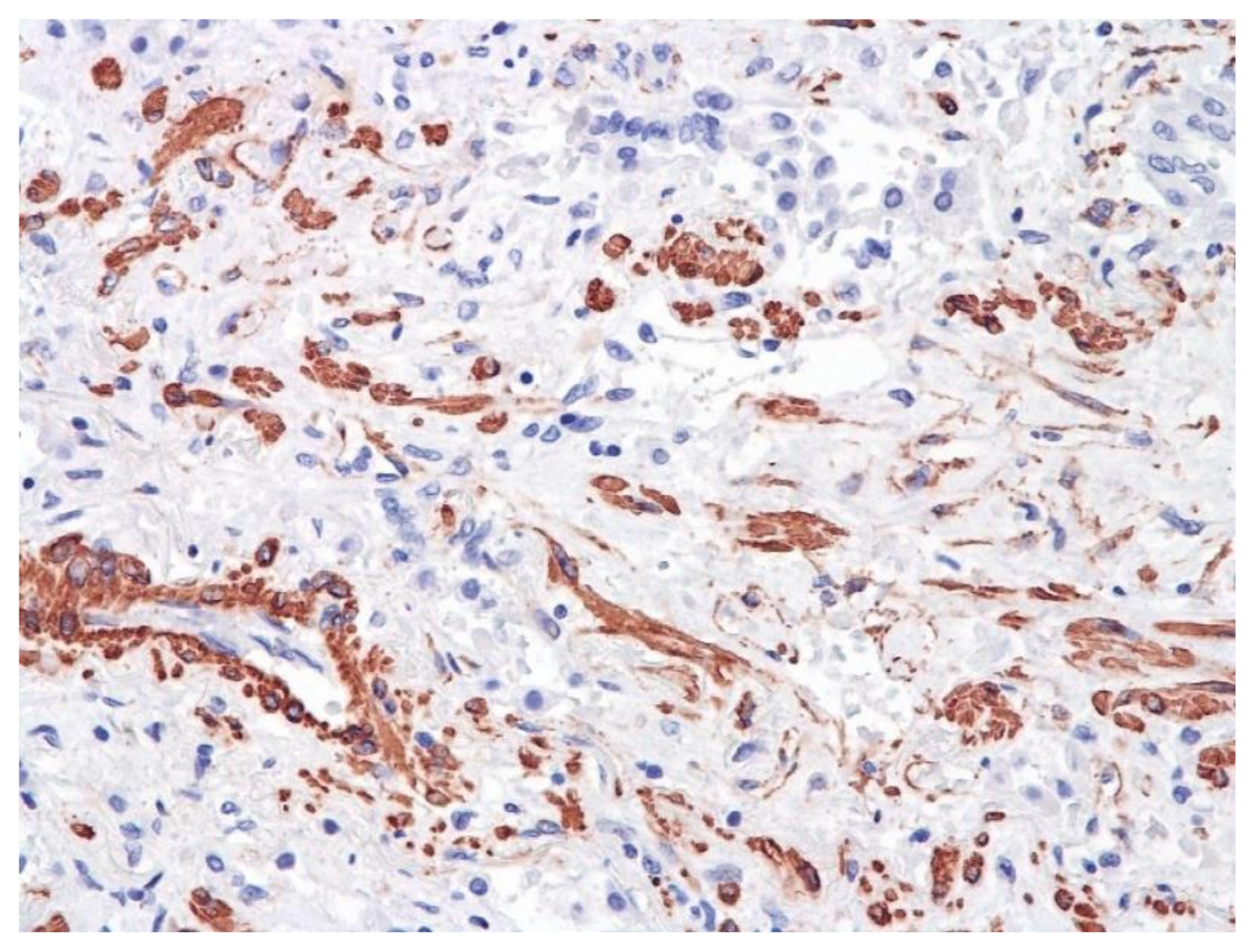 Pathophysiology 29 00021 g014 550