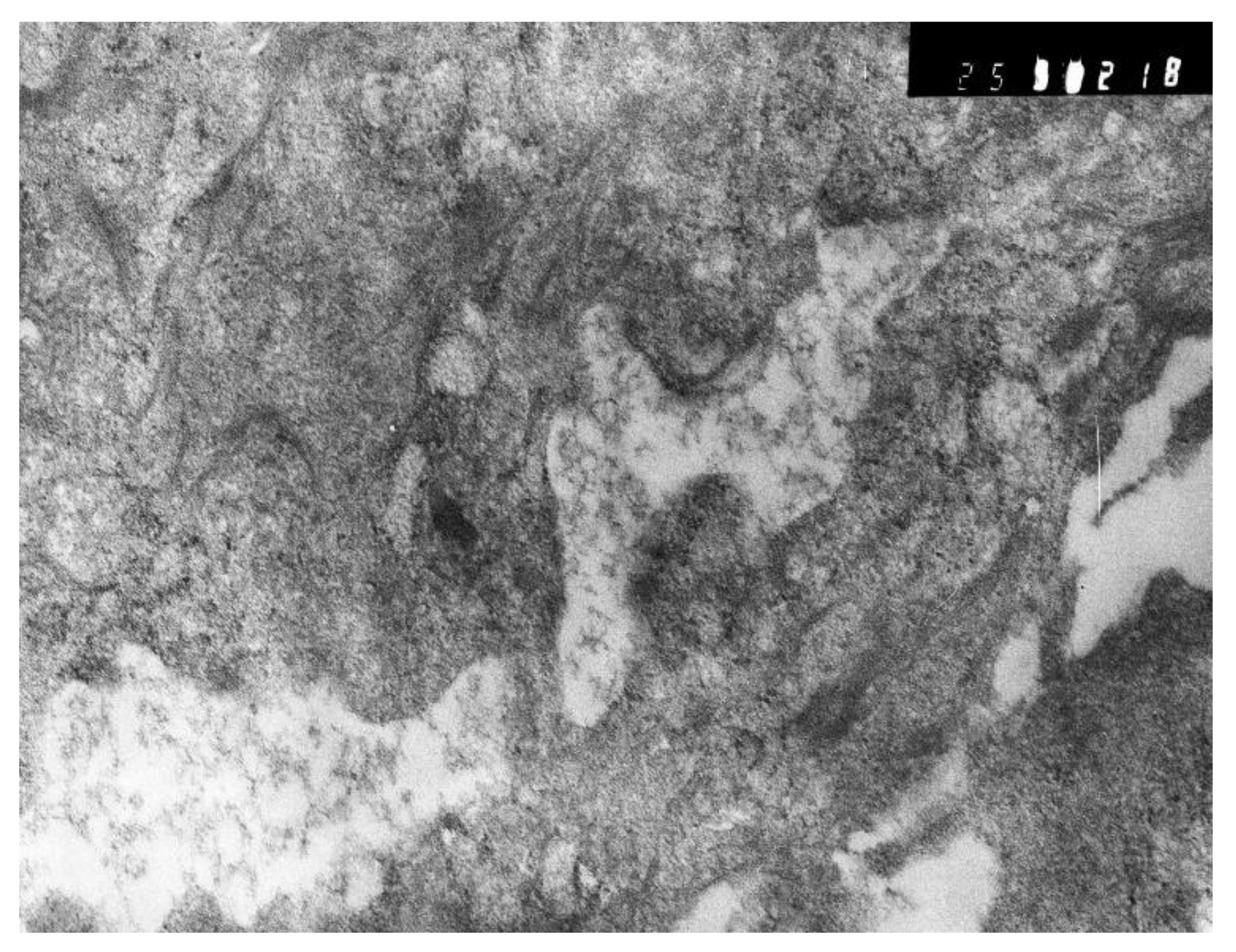 Pathophysiology 29 00021 g015 550