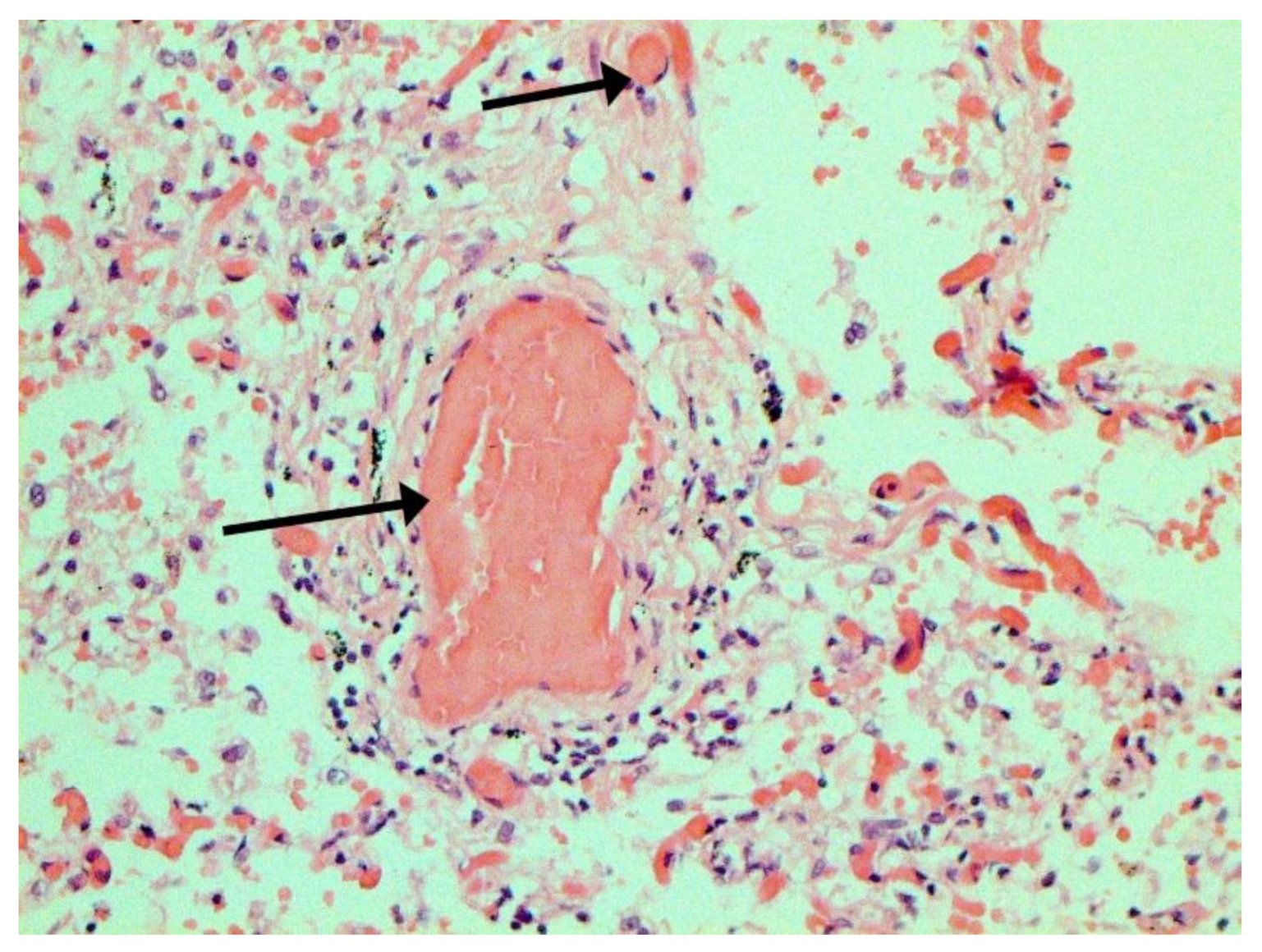 Pathophysiology 29 00021 g016 550