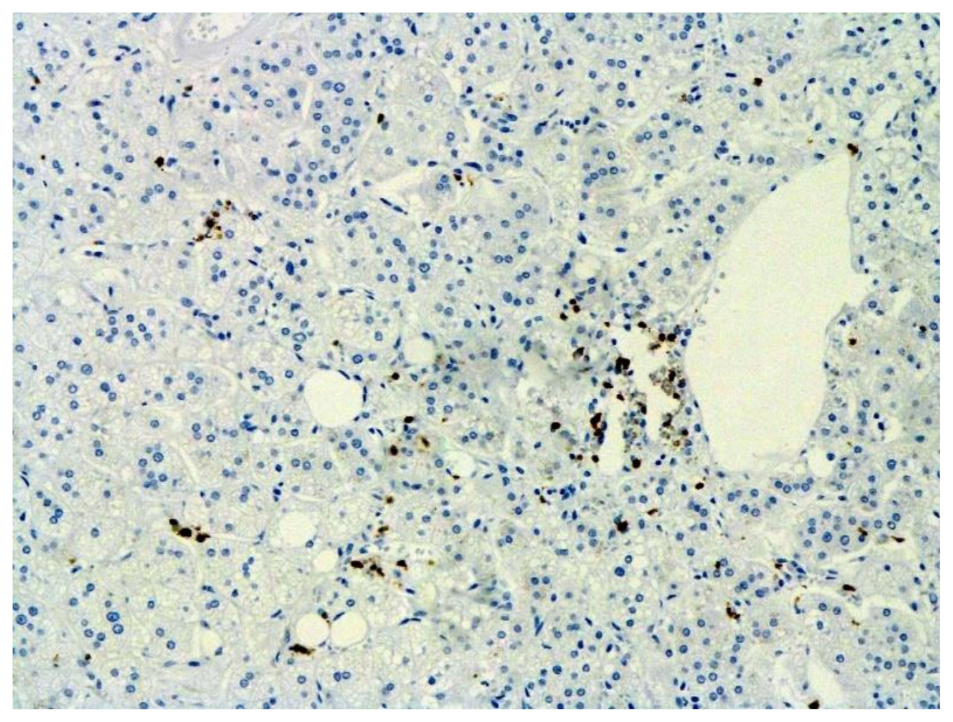 Pathophysiology 29 00021 g018 550
