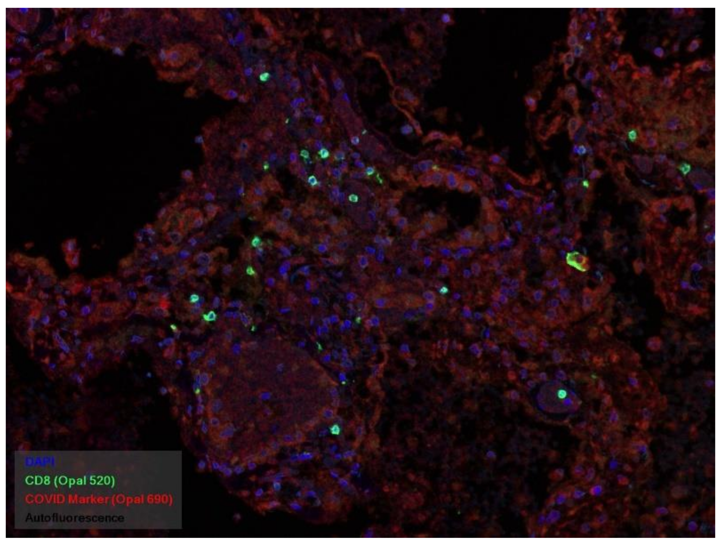 Pathophysiology 29 00021 g020 550