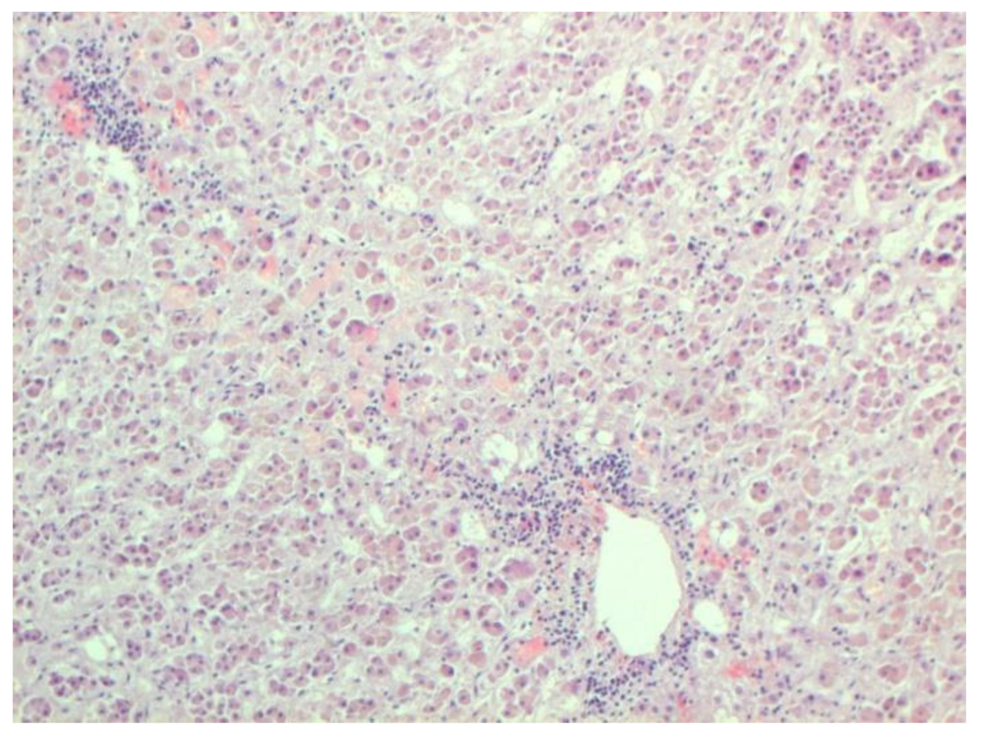 Pathophysiology 29 00021 g021 550