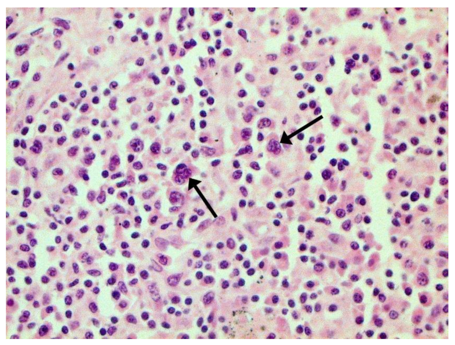 Pathophysiology 29 00021 g023 550