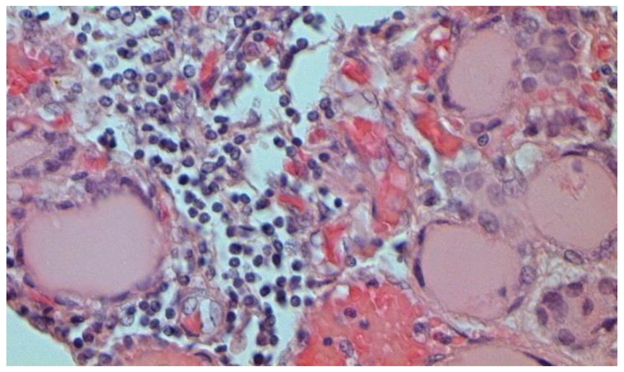 Pathophysiology 29 00021 g025 550