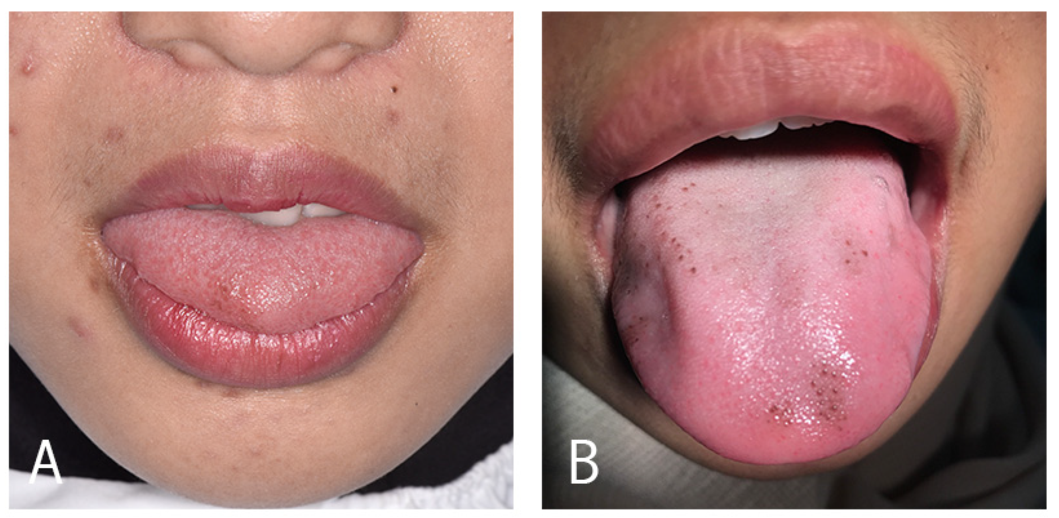 Pathophysiology 29 00043 g001 Pathophysiology 29 00043 g001