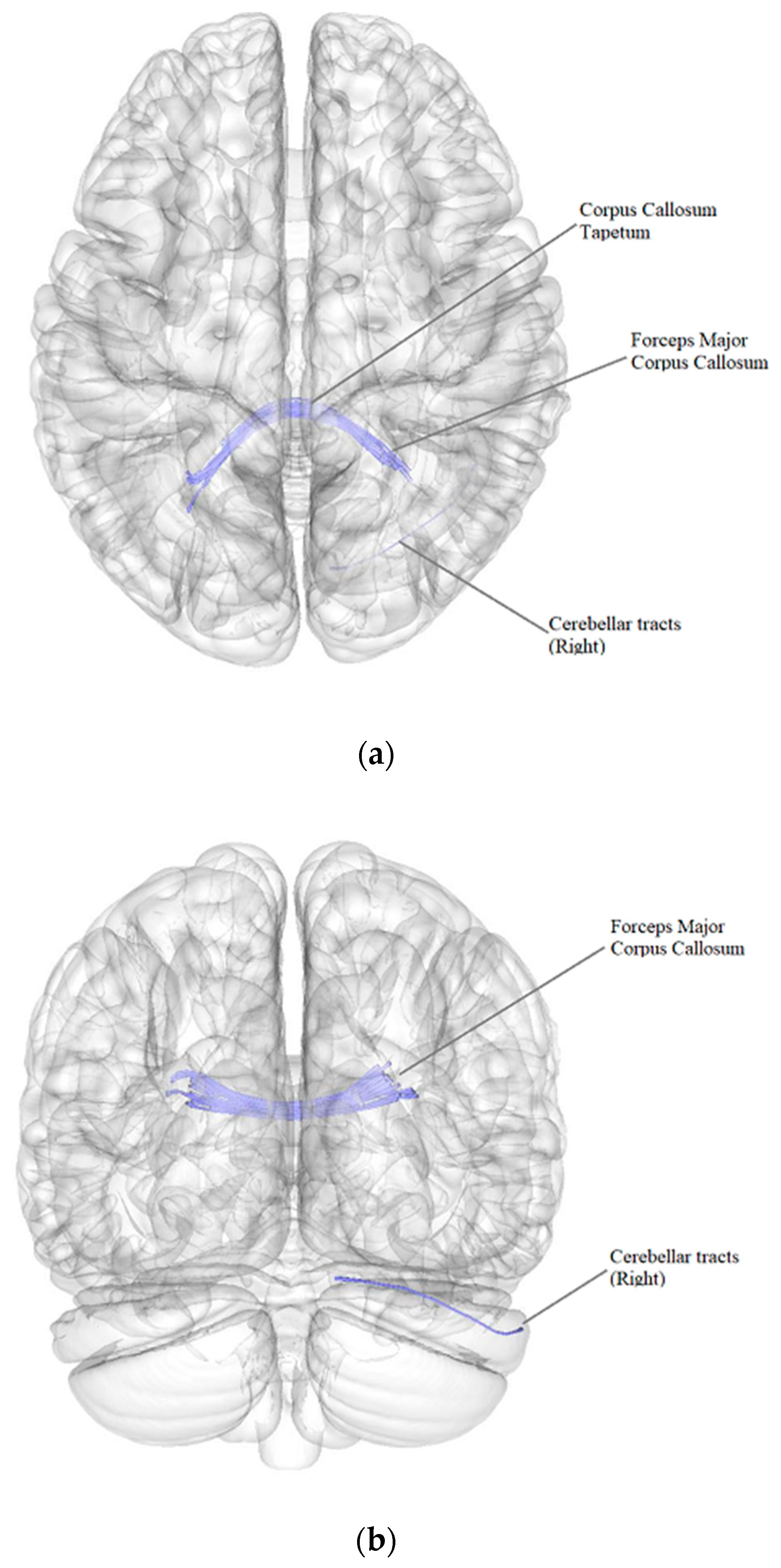 Pathophysiology 29 00046 g002