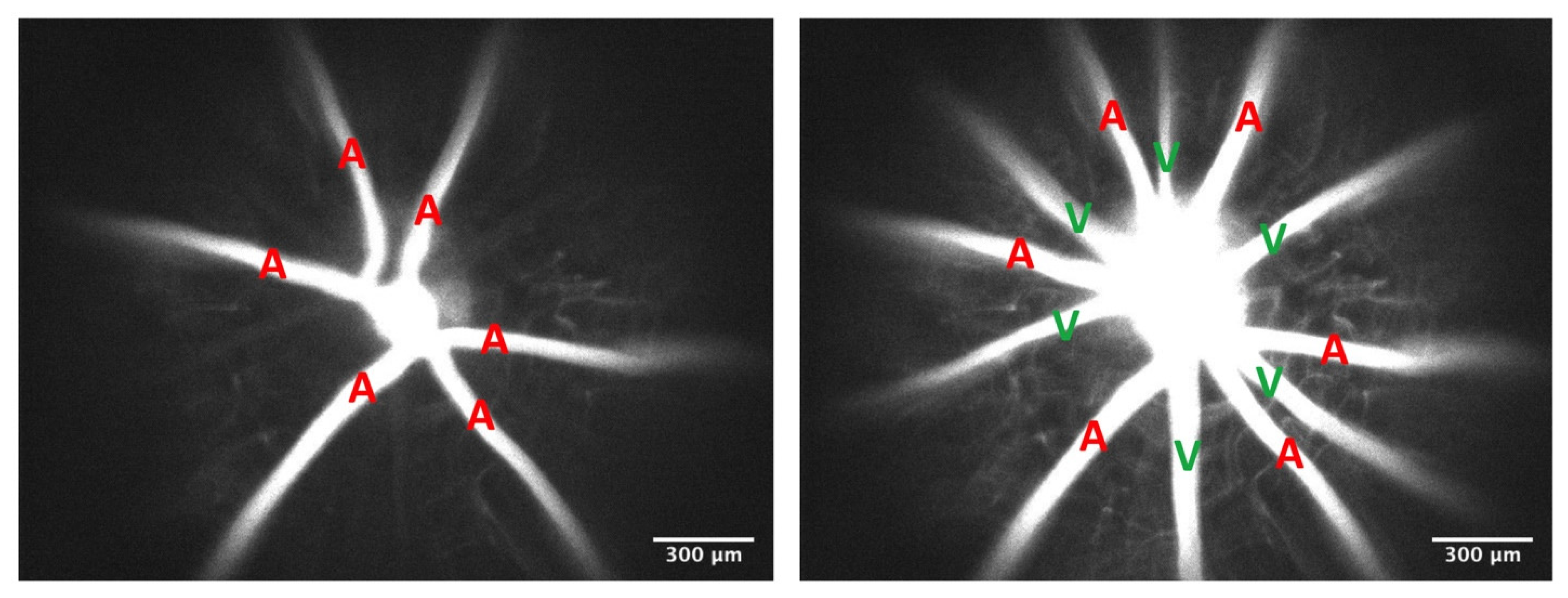 Pathophysiology 29 00052 g001