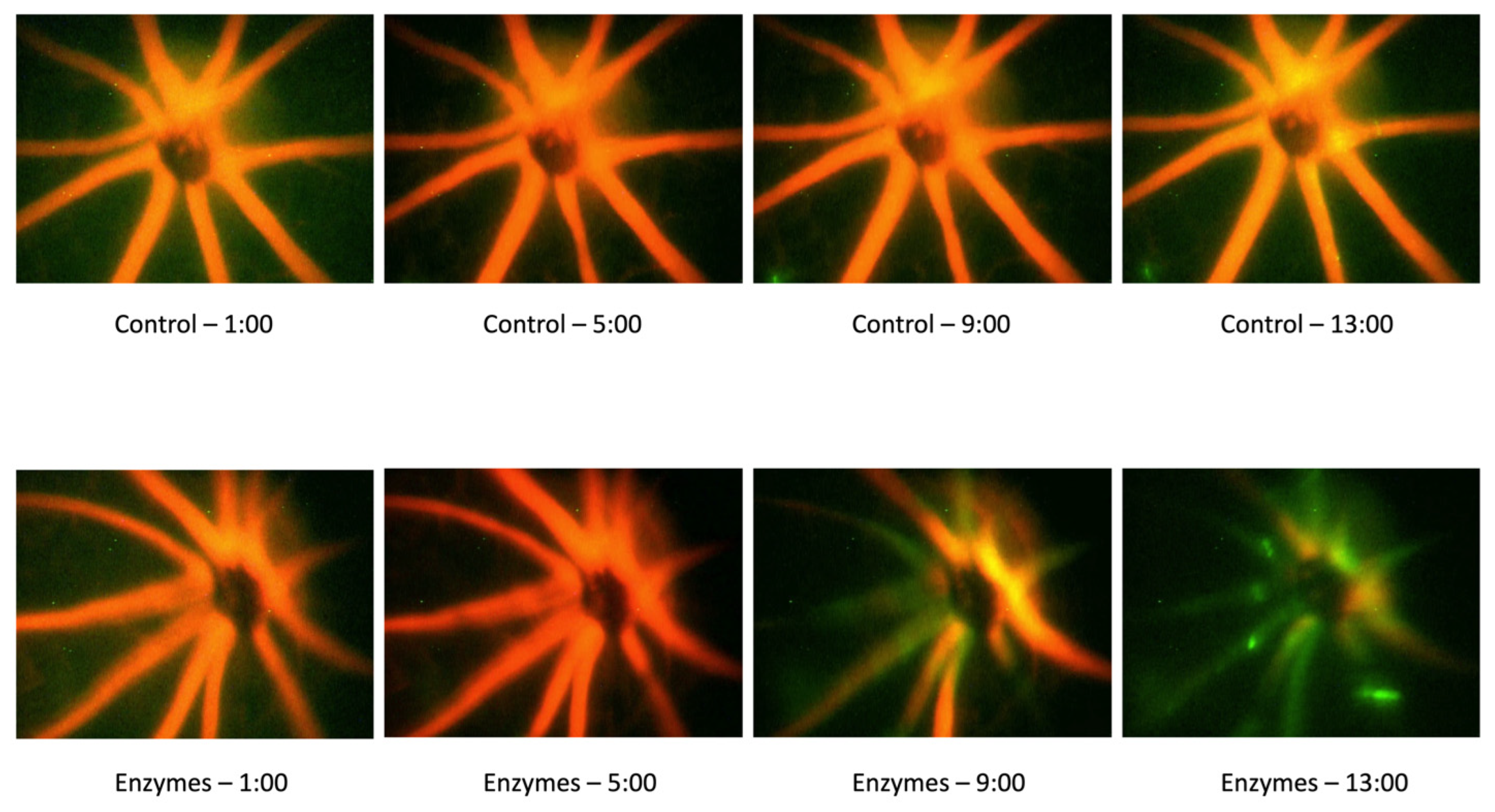 Pathophysiology 29 00052 g006