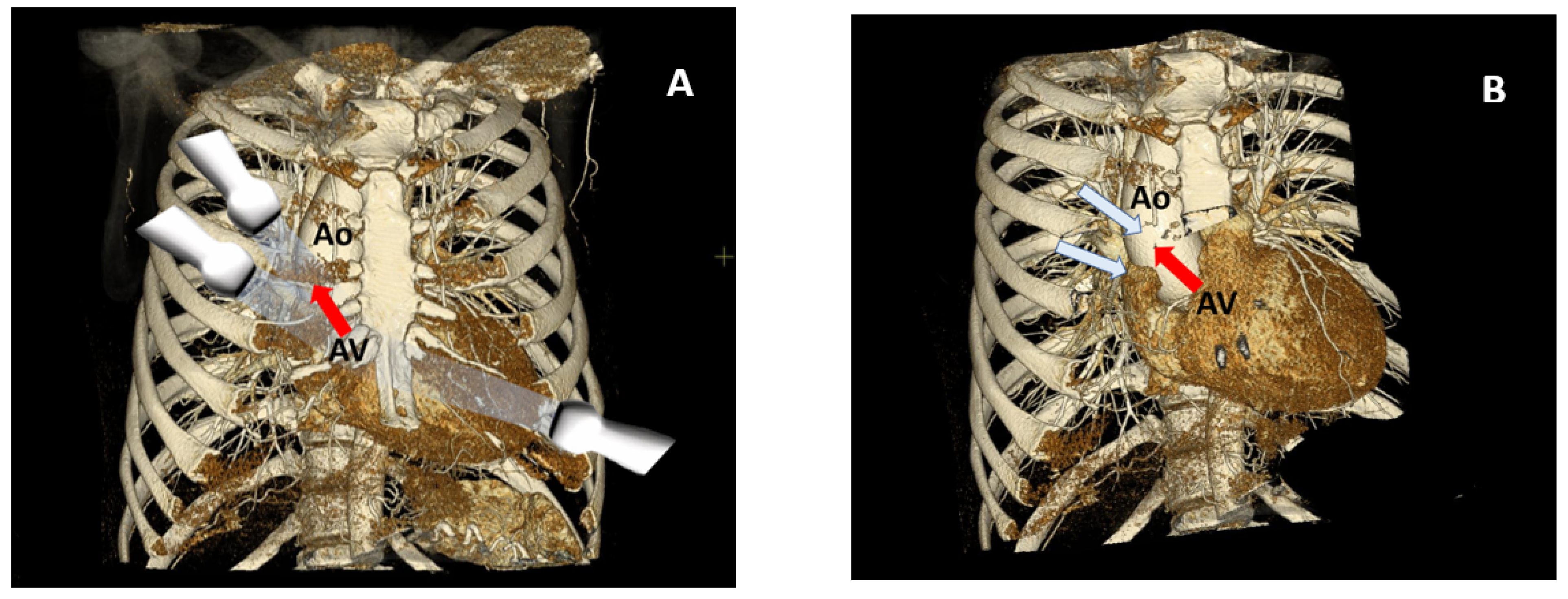Pathophysiology 30 00015 g003 Pathophysiology 30 00015 g003