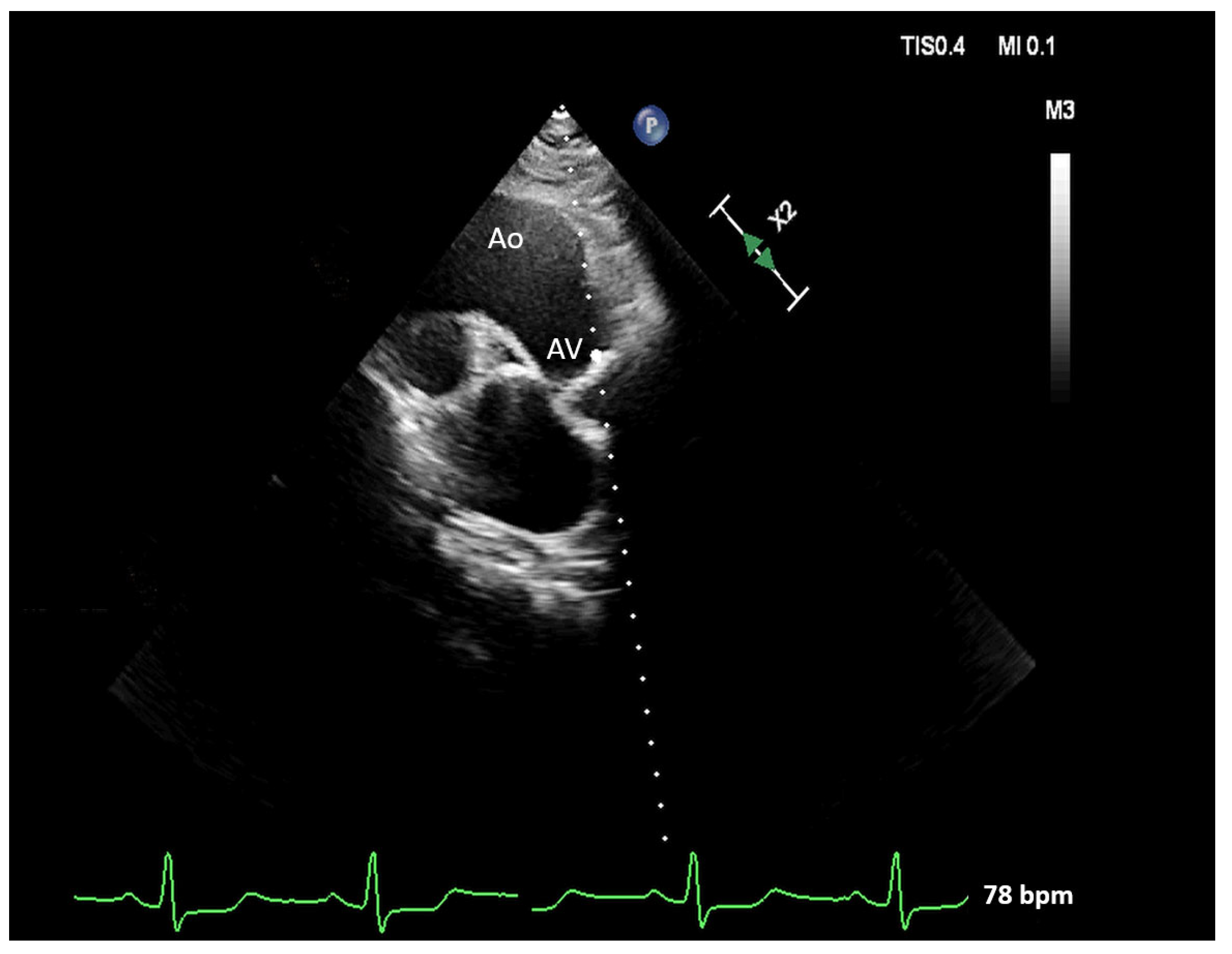 Pathophysiology 30 00015 g004 Pathophysiology 30 00015 g004