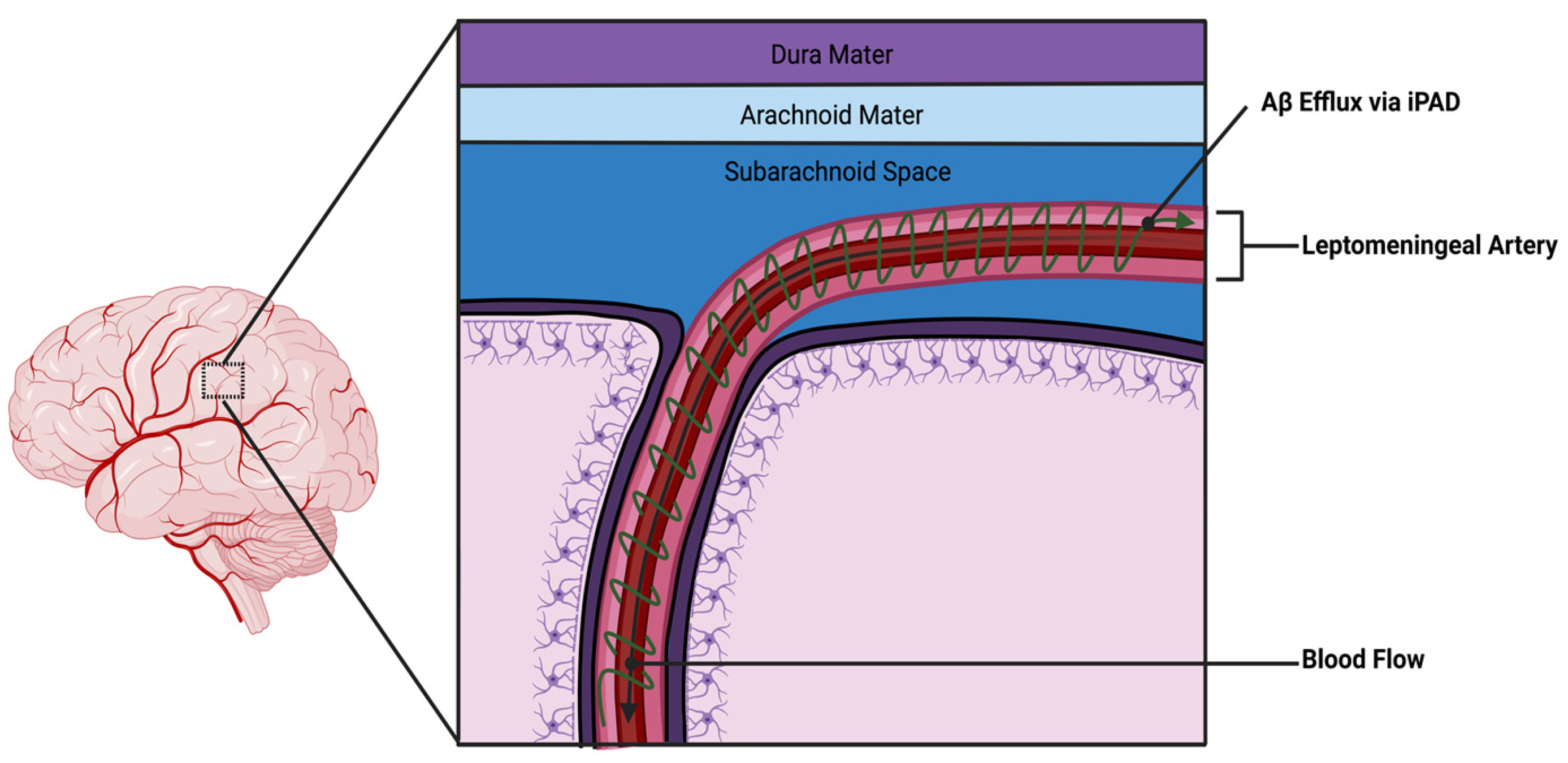 Frontiers  Delayed Cerebral Ischemia After Subarachnoid